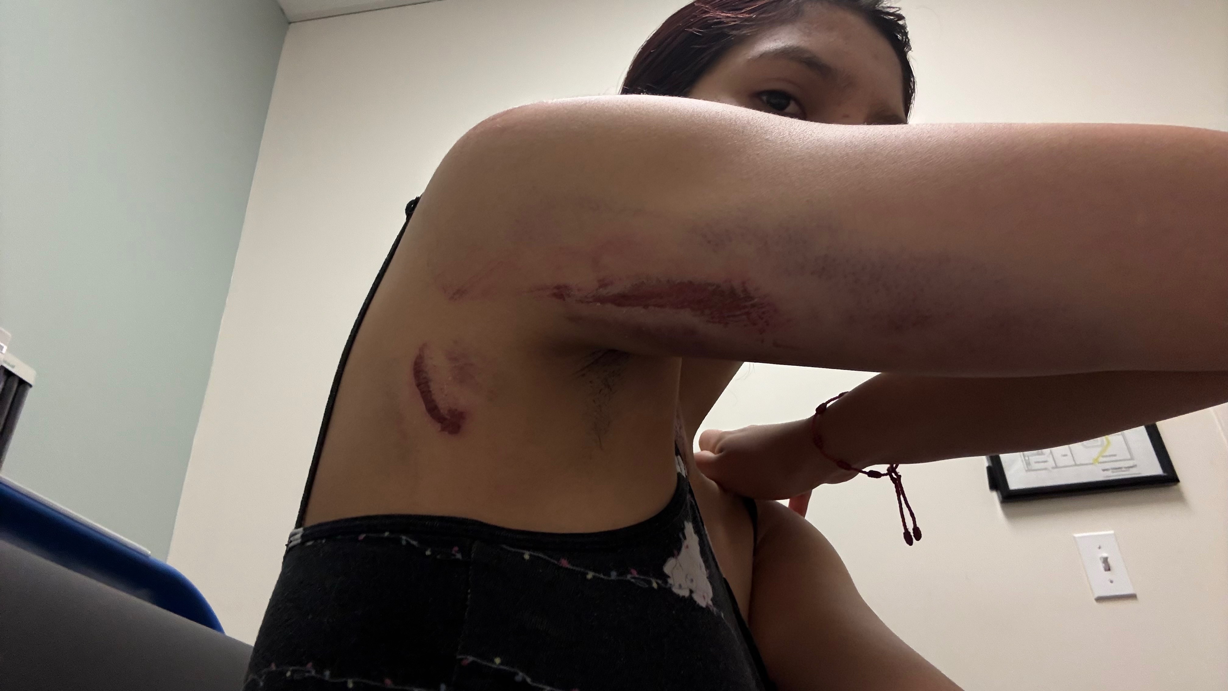 Support Cyd’s Recovery After Her Accident campaign photo, 2 of 8