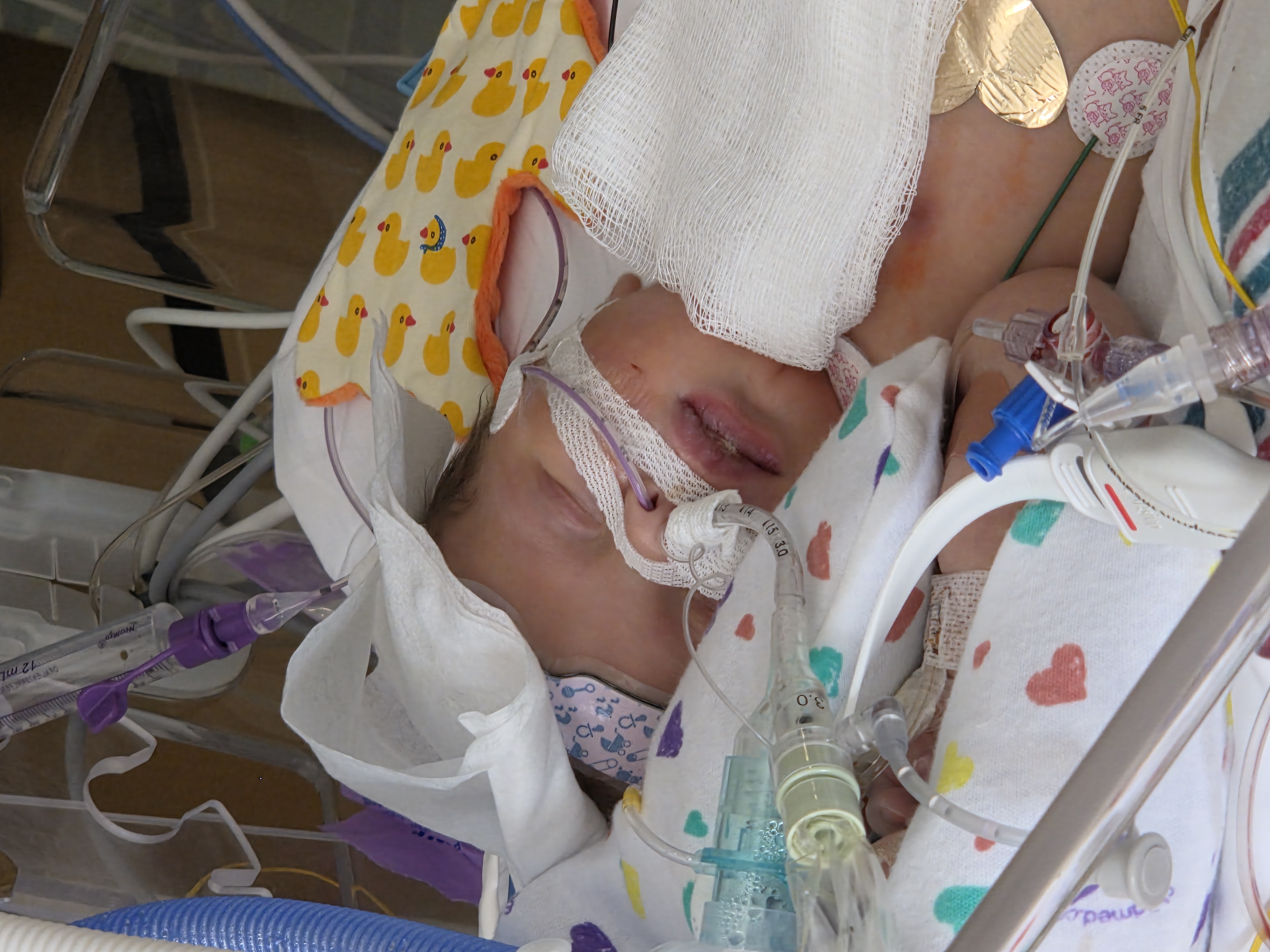 Help Angel Fight Hypoplastic Left Heart Syndrome campaign photo, 2 of 11