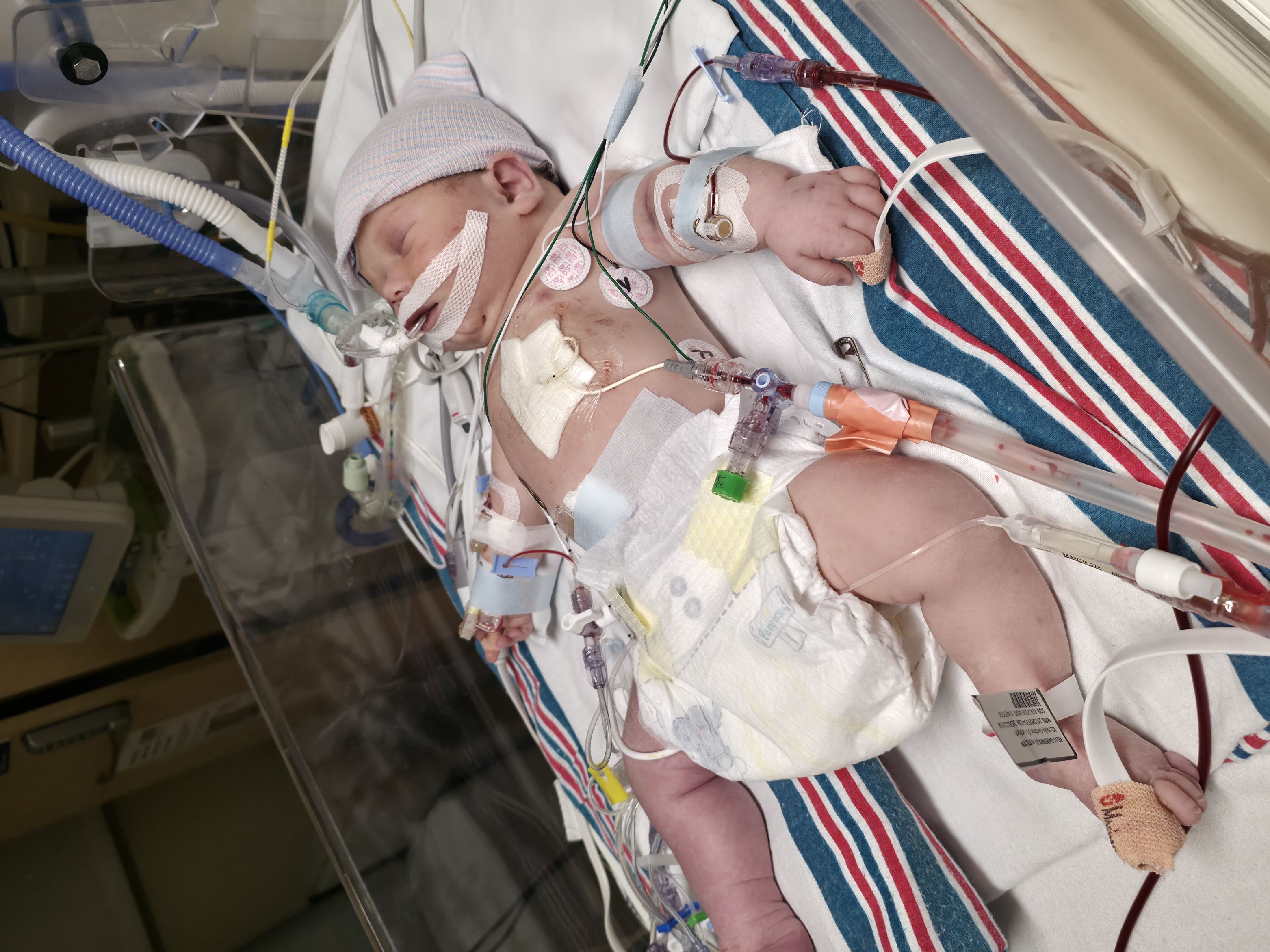 Help Angel Fight Hypoplastic Left Heart Syndrome campaign photo, 6 of 11