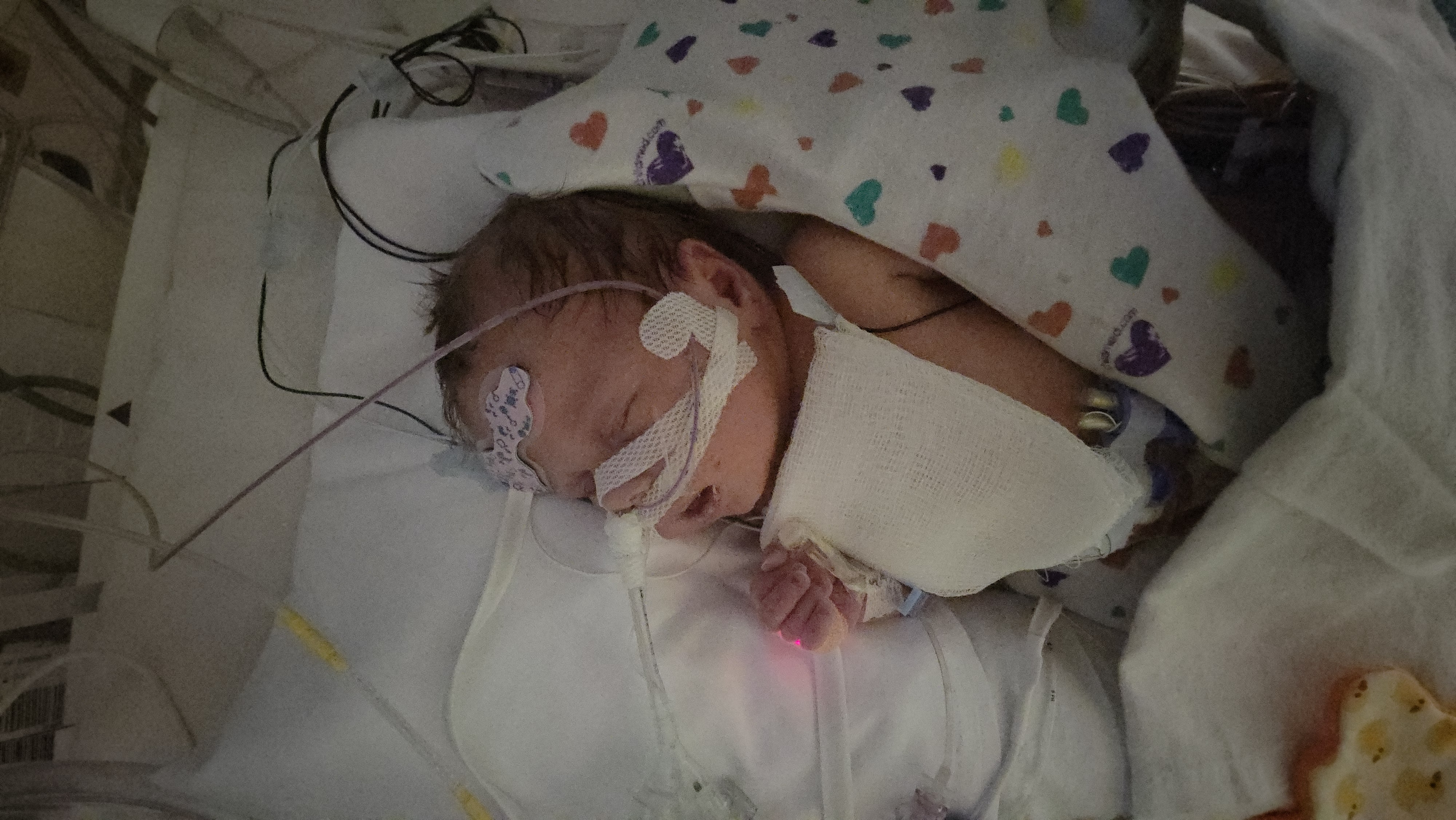 Help Angel Fight Hypoplastic Left Heart Syndrome campaign photo, 7 of 11