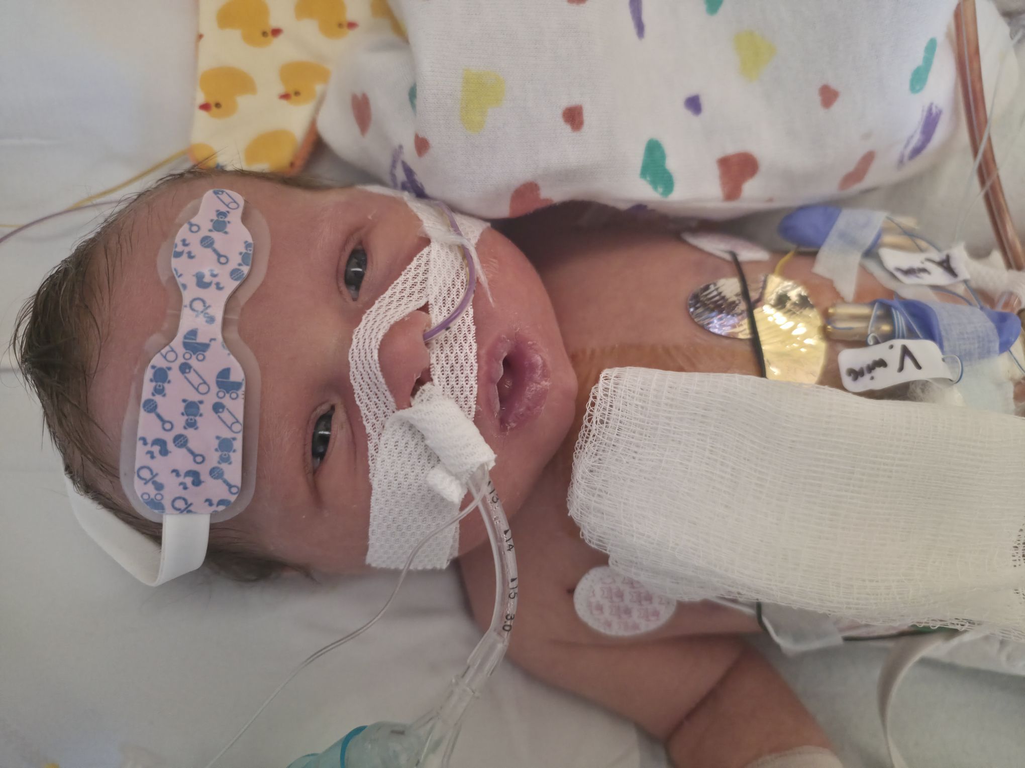 Help Angel Fight Hypoplastic Left Heart Syndrome campaign photo, 8 of 11