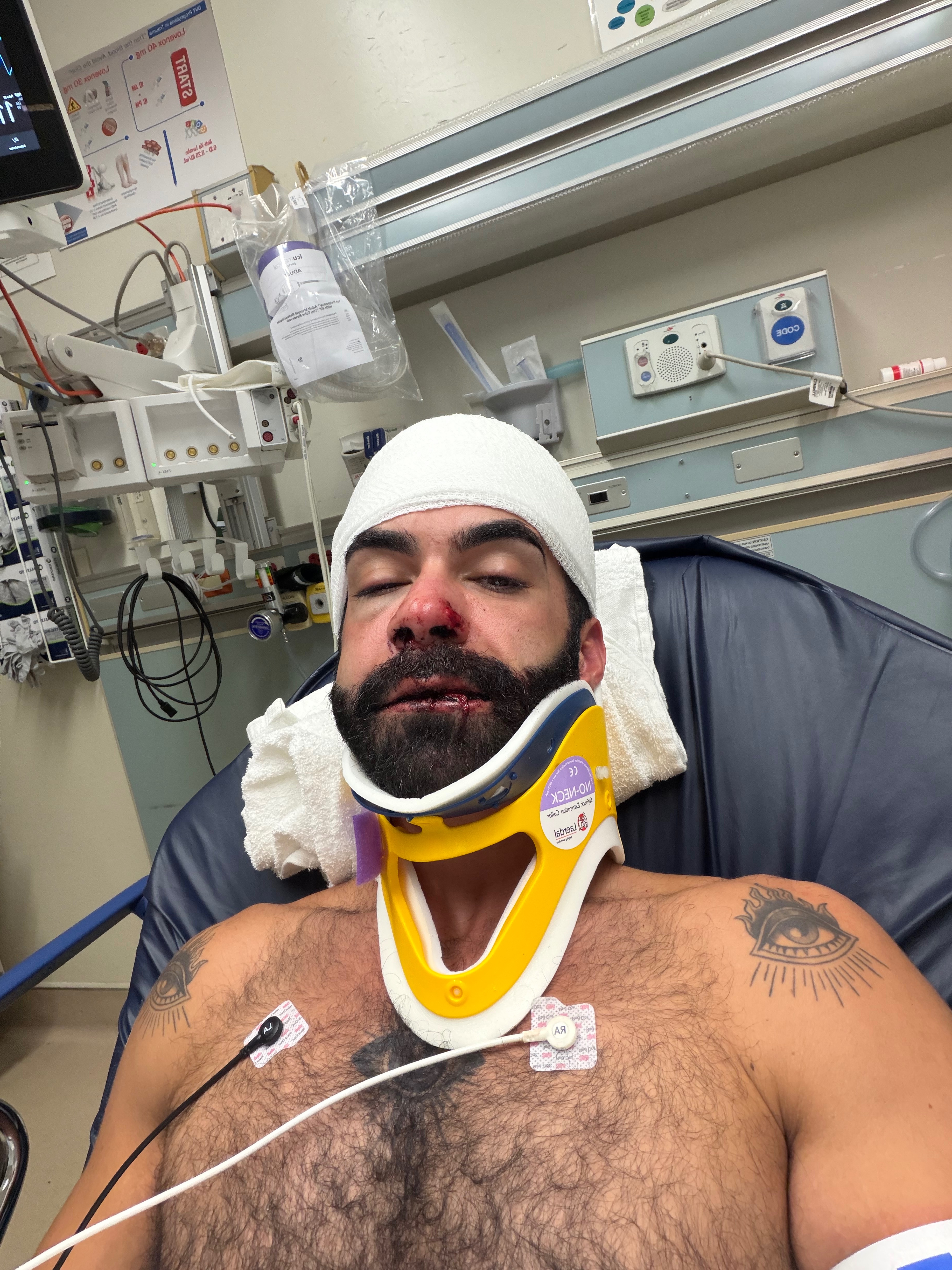 Fundraiser by Joey T ️ Help Joey Recover After Being Hit by a Drunk — free download