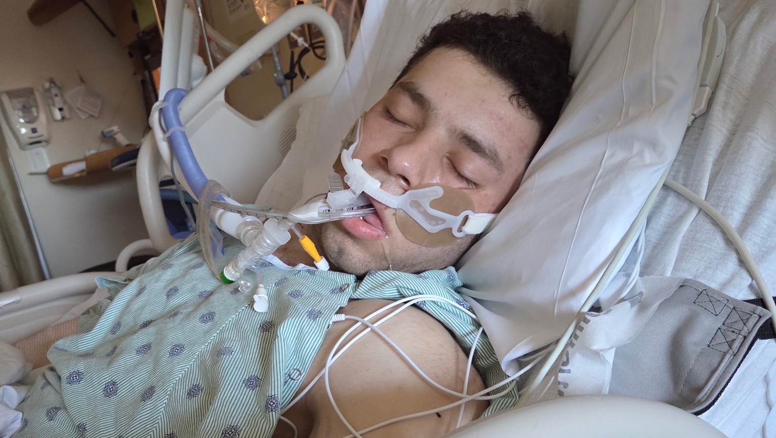 Fundraiser by Jacob Burger : Support Jacob’s Recovery After Accident