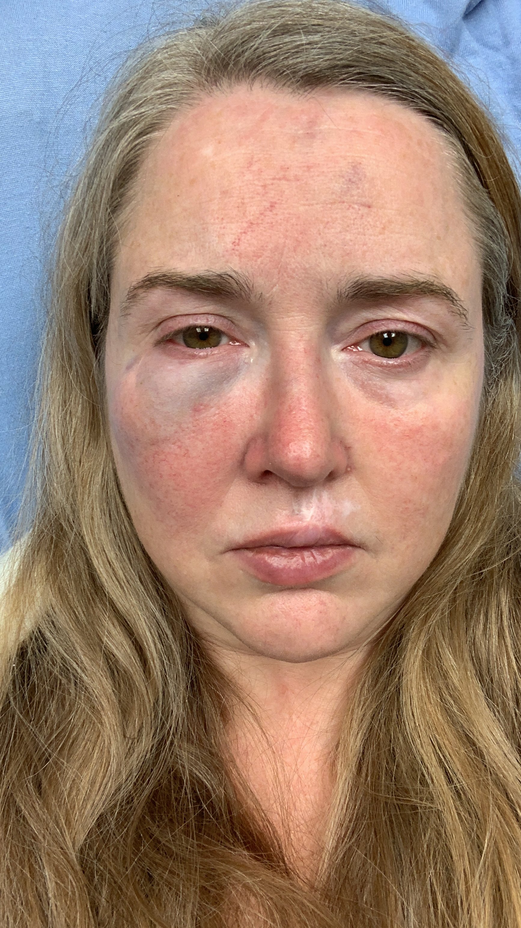 Support My Journey to Healing and Recovery campaign photo, 4 of 5