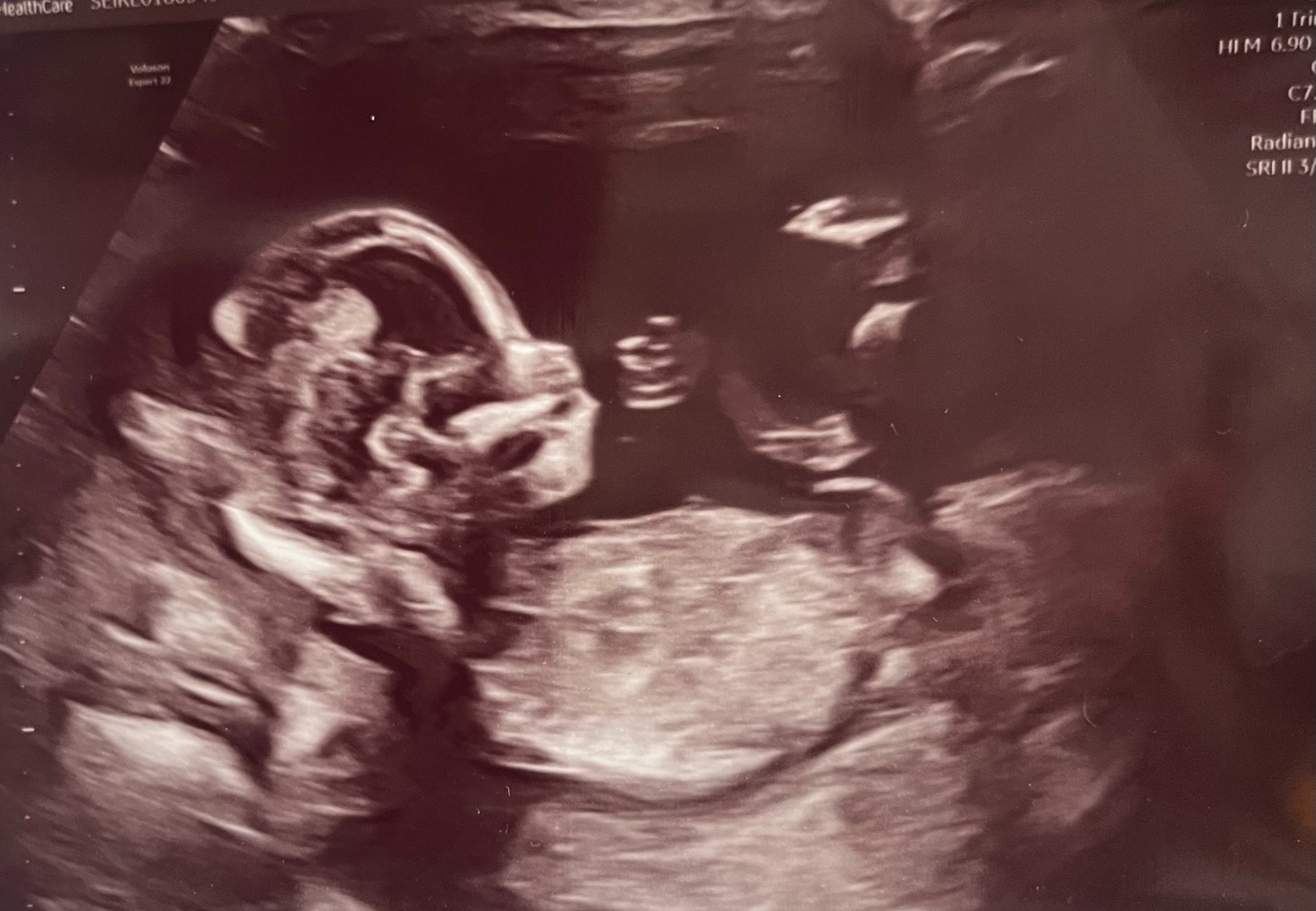Help Me Finish My Novel Before Baby Arrives campaign photo, 4 of 6
