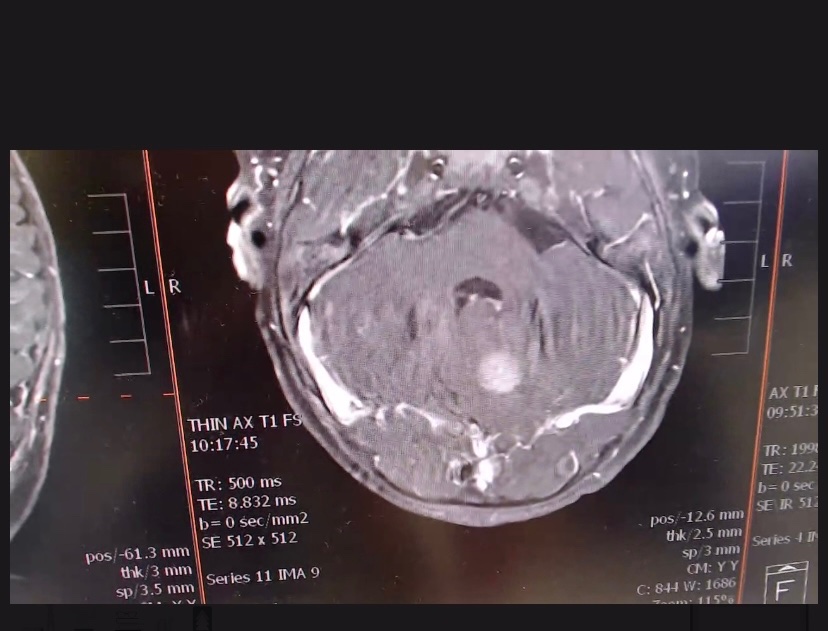 Support Asher’s Brain Surgery and Recovery campaign photo, 6 of 7