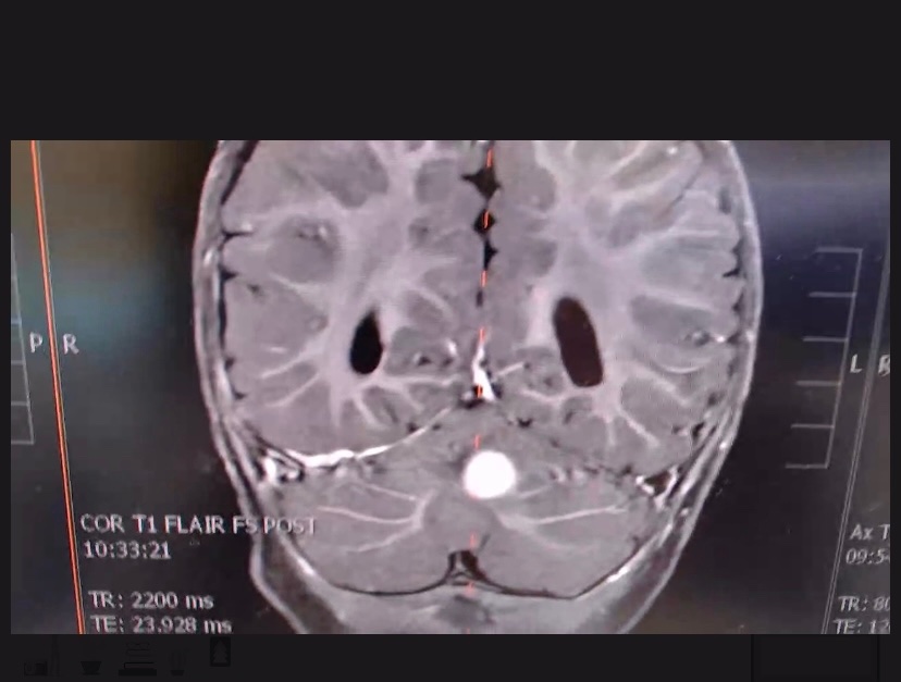 Support Asher’s Brain Surgery and Recovery campaign photo, 2 of 7