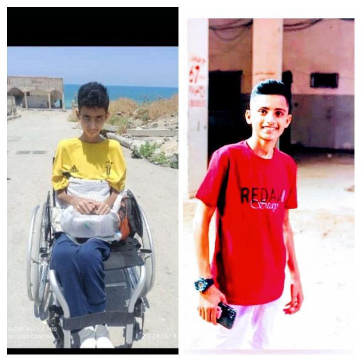 Help 18-Year-Old Gaza Survivor Mohammed Walk Again campaign photo, 2 of 8