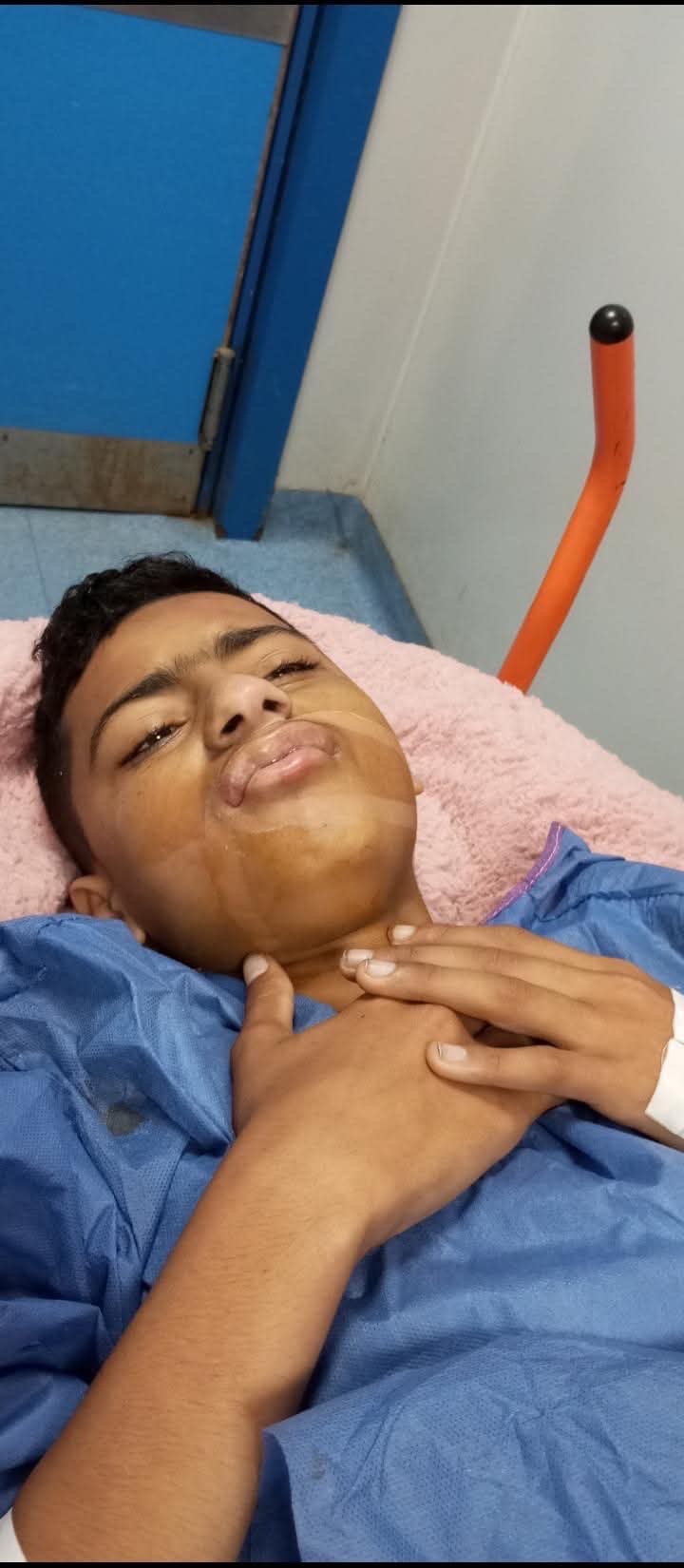 Help 18-Year-Old Gaza Survivor Mohammed Walk Again campaign photo, 5 of 8