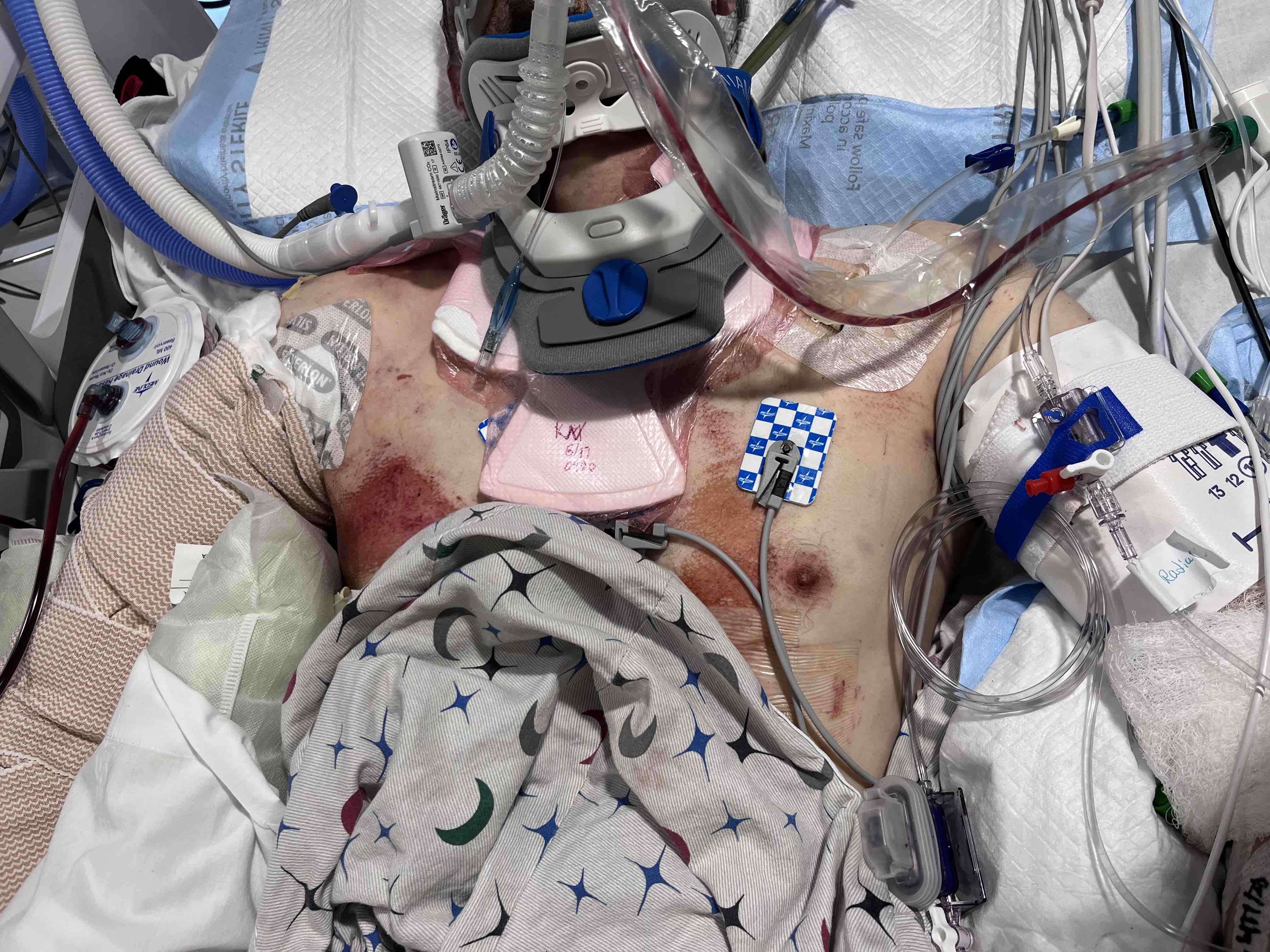 Help CJ Recover After Accident campaign photo, 6 of 7