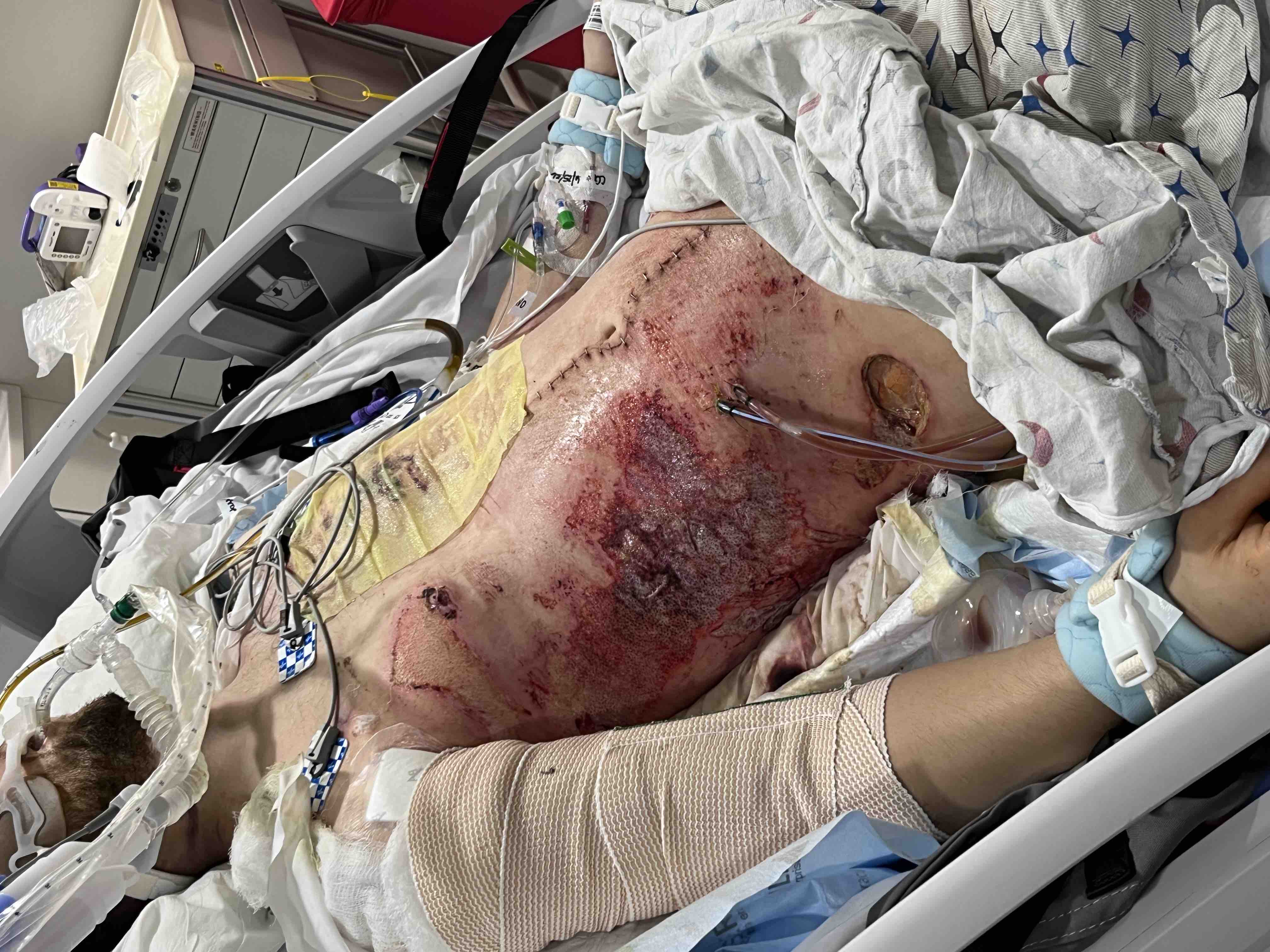 Help CJ Recover After Accident campaign photo, 5 of 7