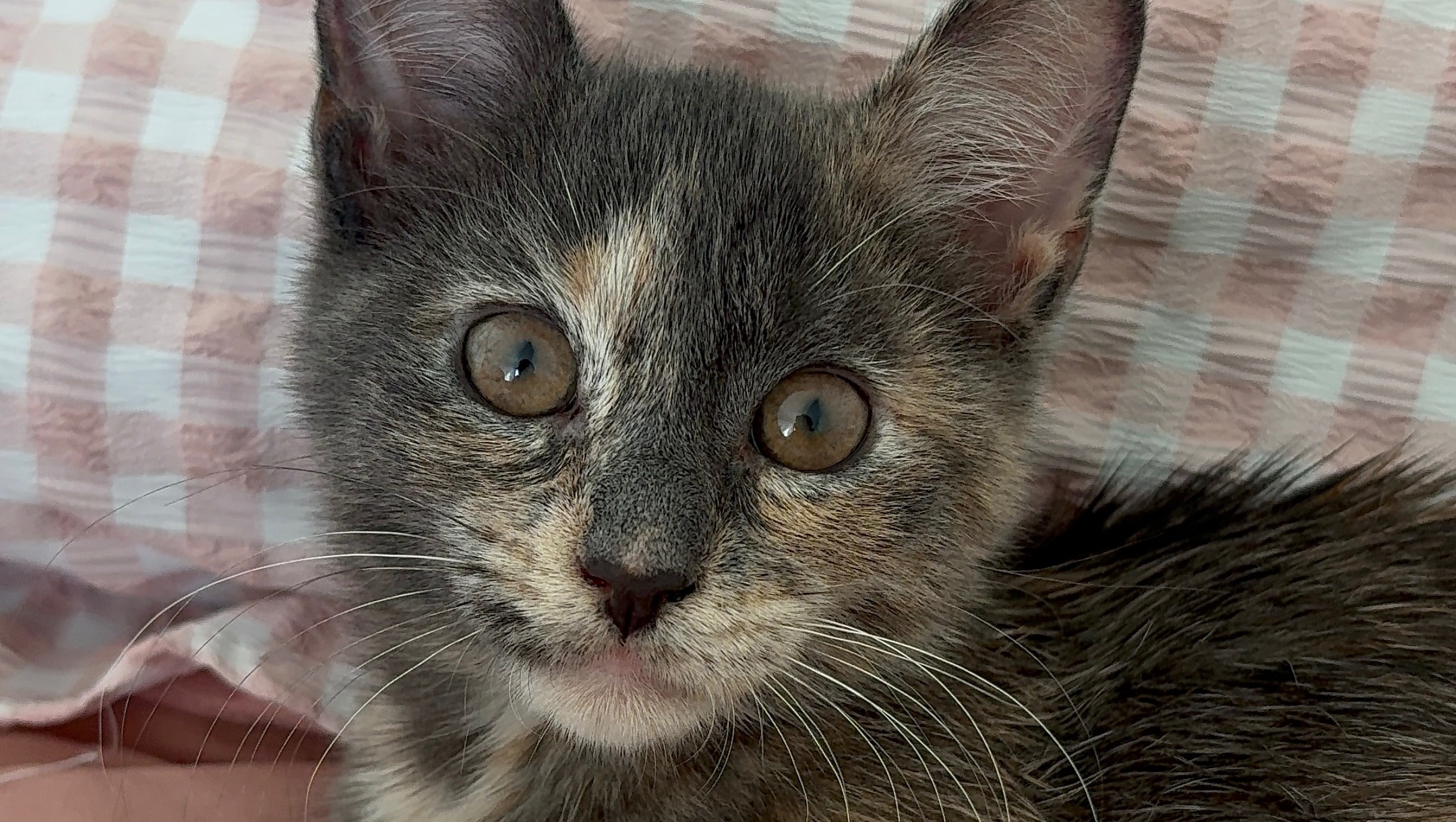Help Ash Get the Surgery She Needs photo