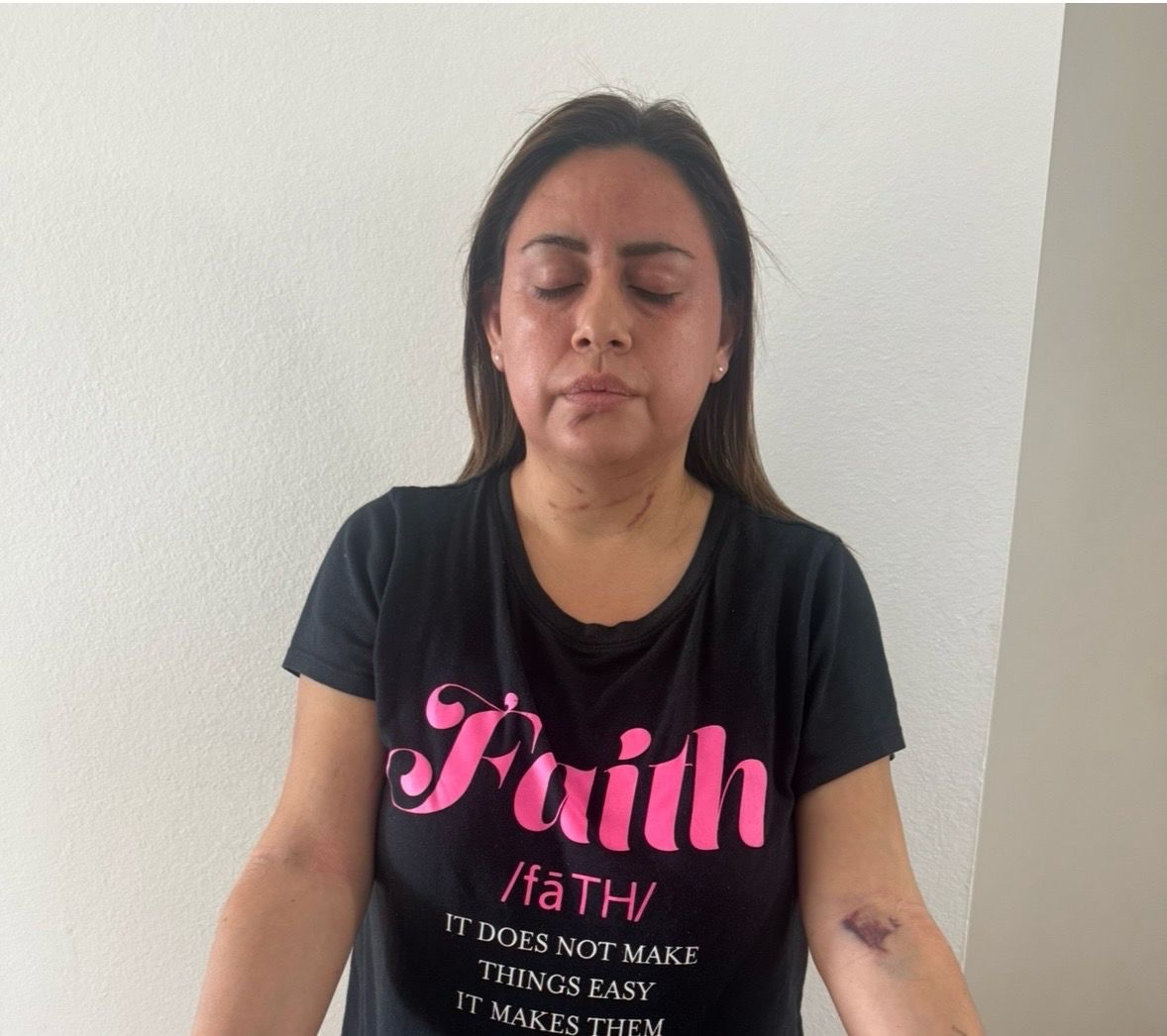 Support Geisel Tello’s Recovery After Death  Attack campaign photo, 2 of 4