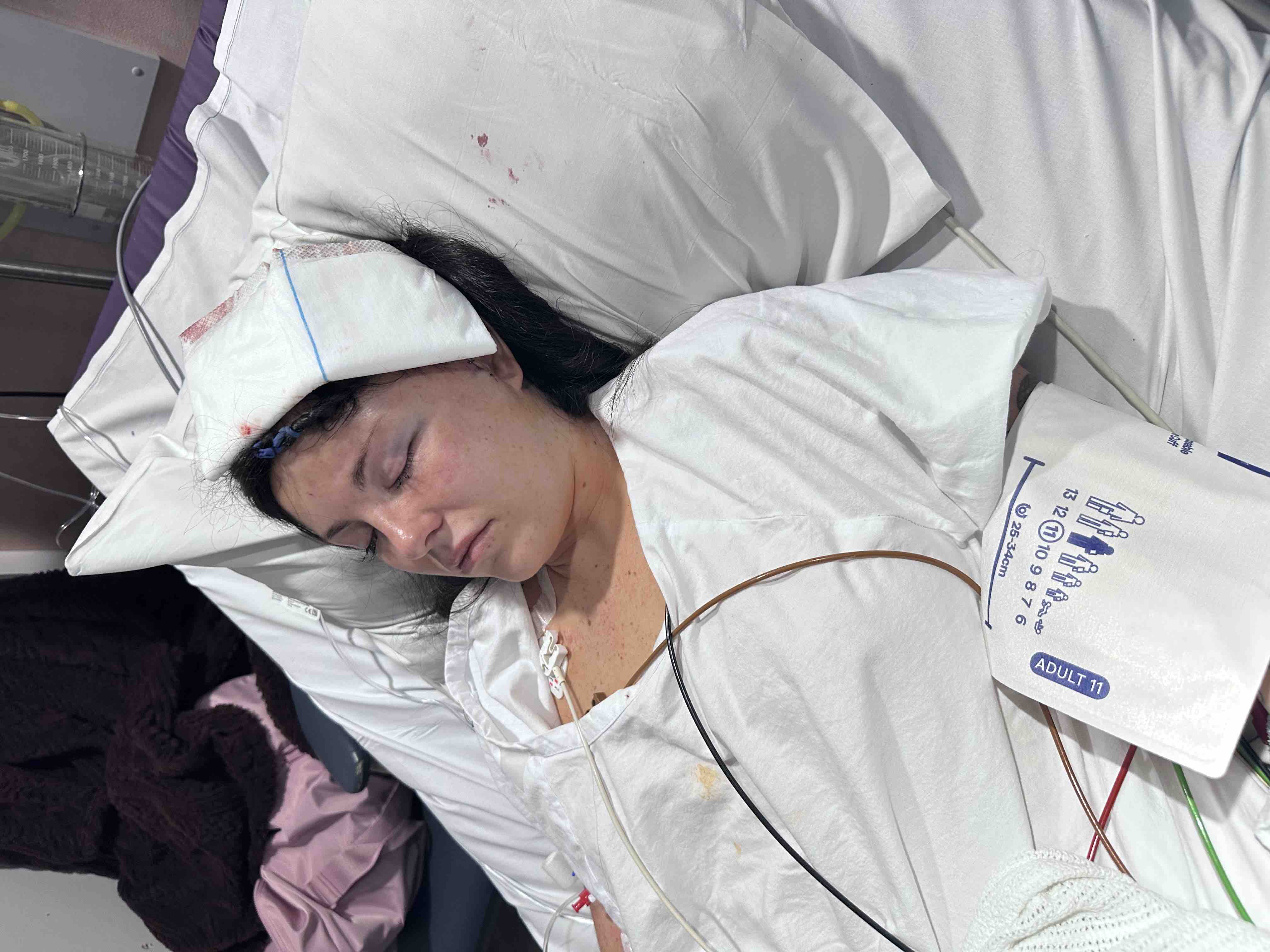 Briana's brain tumour removal recovery campaign photo, 2 of 4