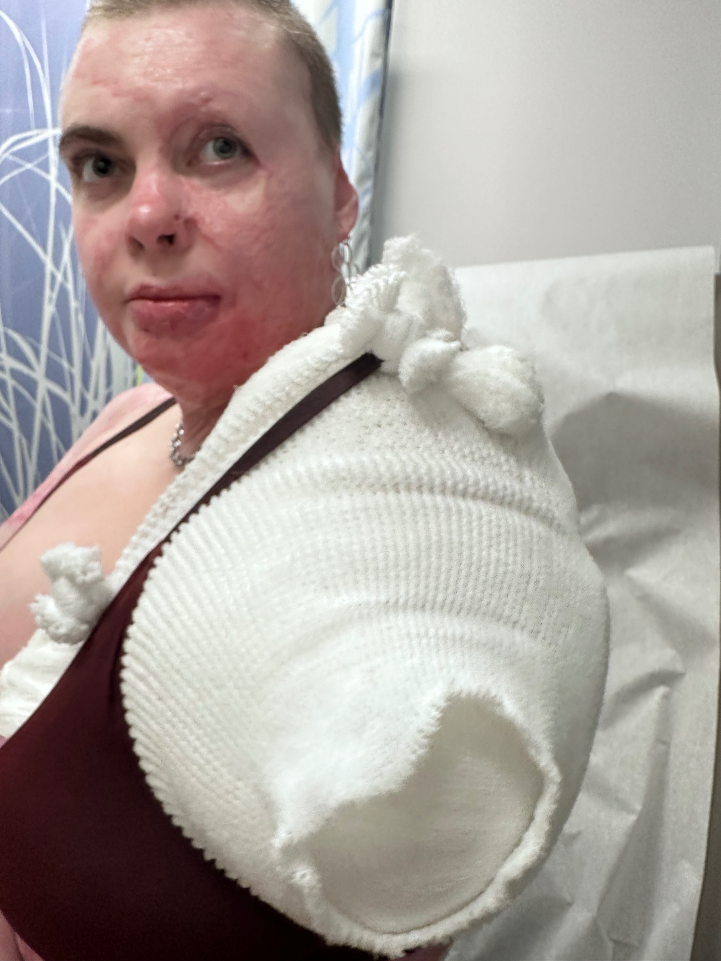 Support Stevi’s Healing Journey campaign photo, 4 of 8