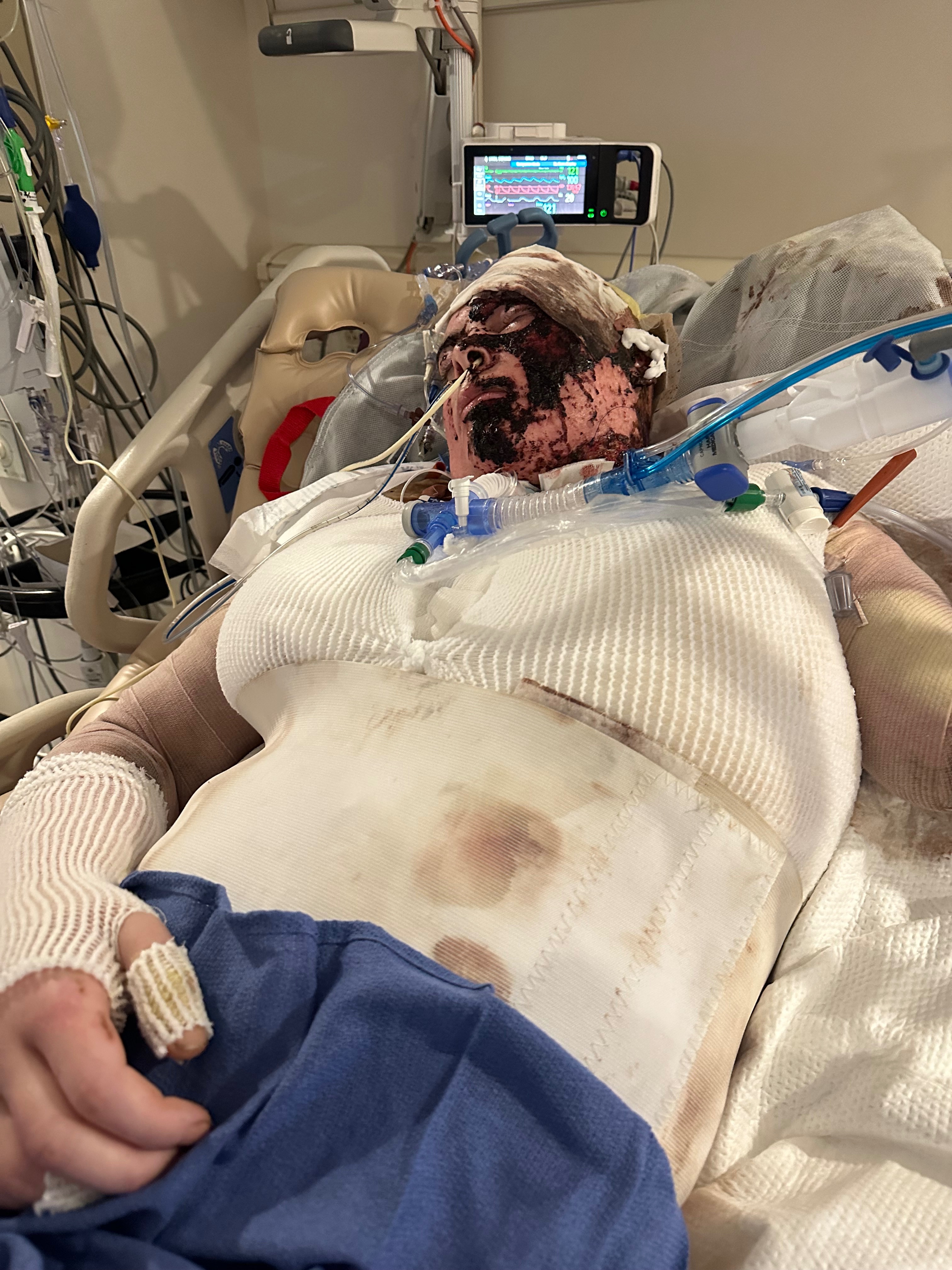 Support Stevi’s Healing Journey campaign photo, 5 of 8