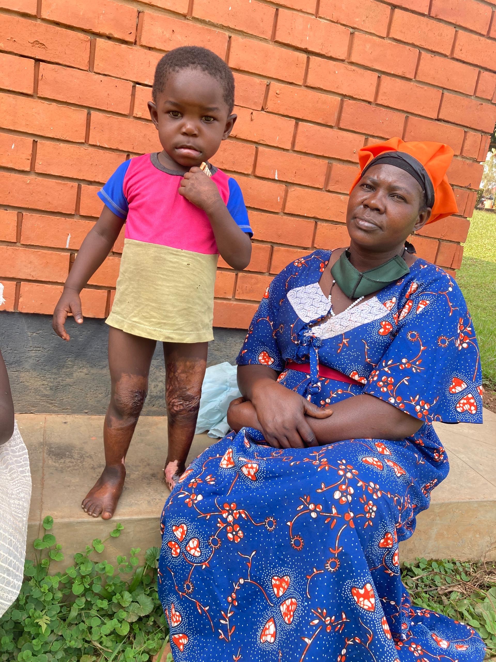 Help a Ugandan Mother Save Her Burned Child campaign photo, 5 of 6
