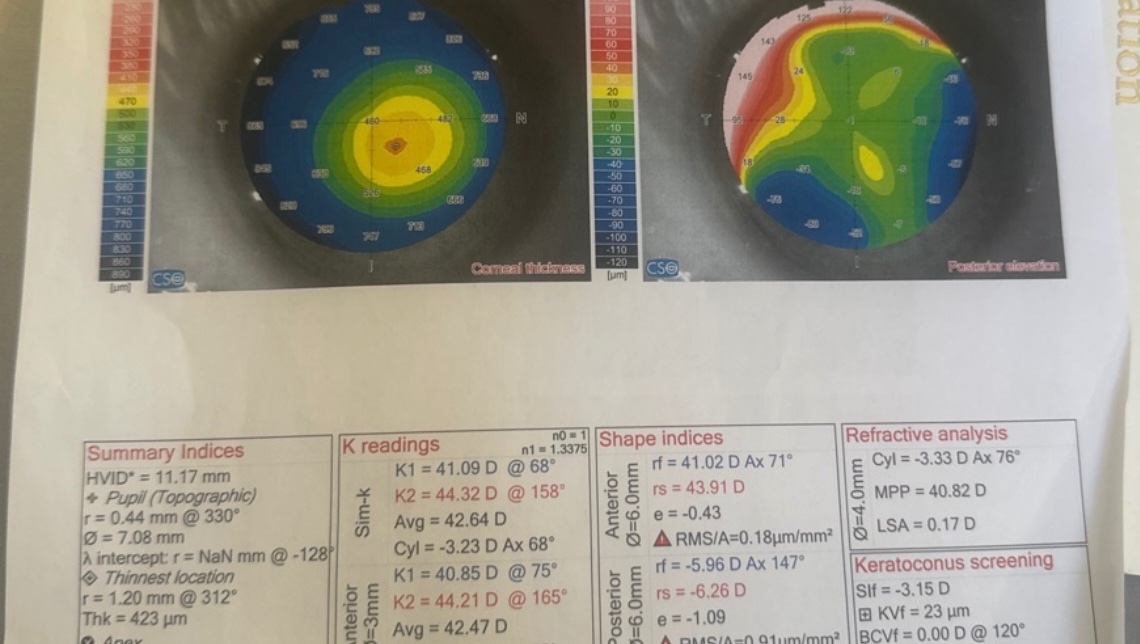 Help Restore My Sight and Independence photo
