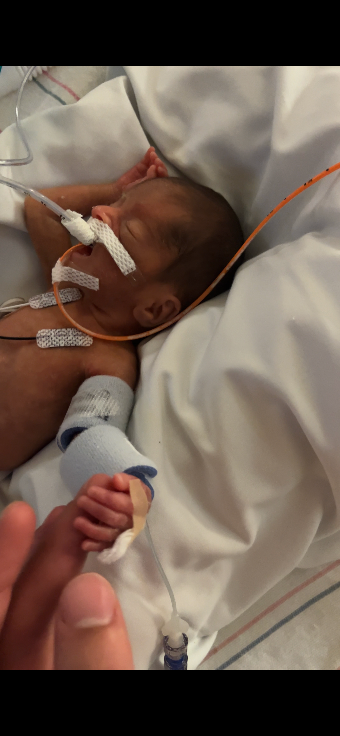 Standing With Jaconi: A Tiny Fighter’s NICU Journey campaign photo, 4 of 7