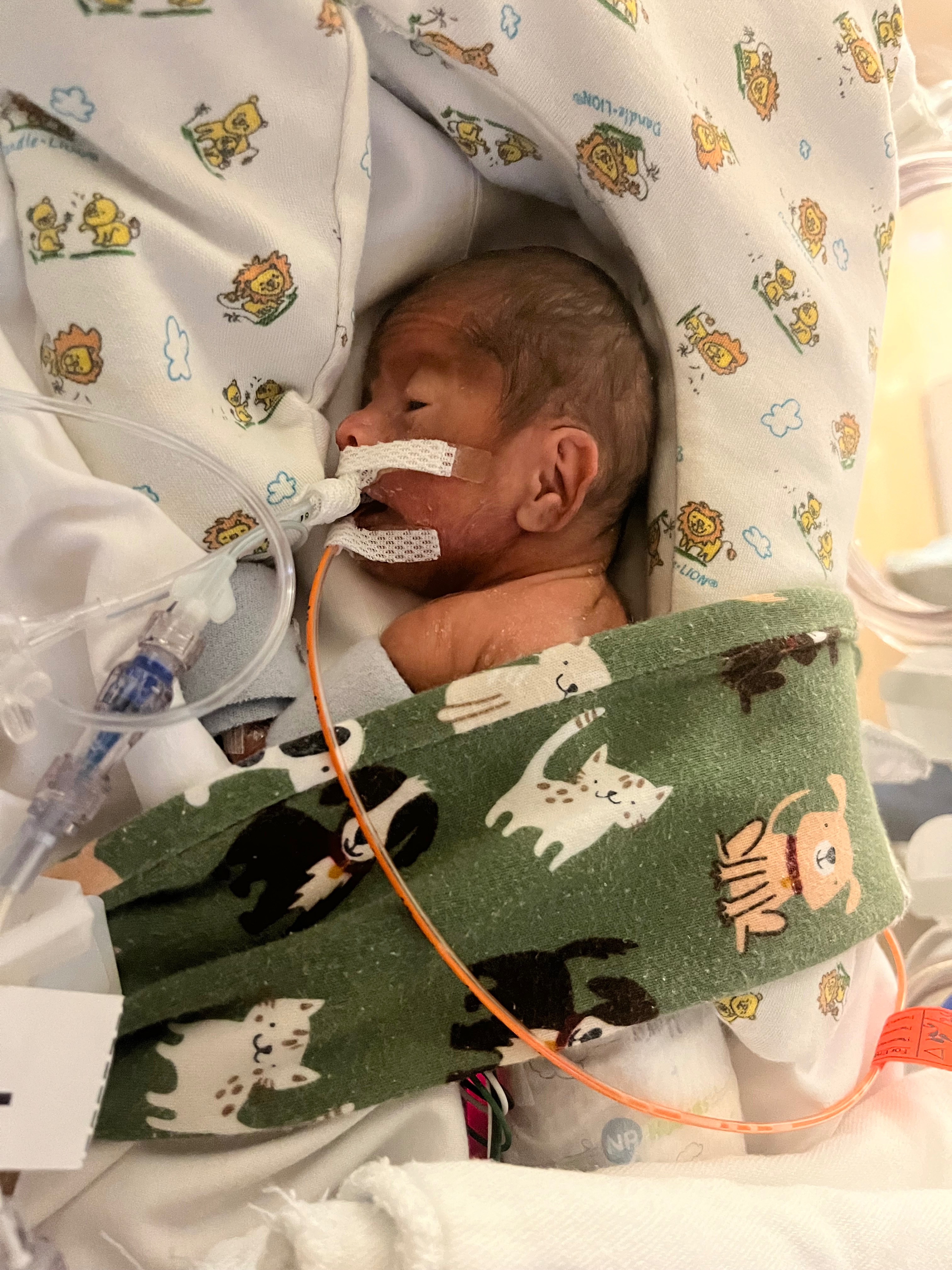 Standing With Jaconi: A Tiny Fighter’s NICU Journey campaign photo, 5 of 7