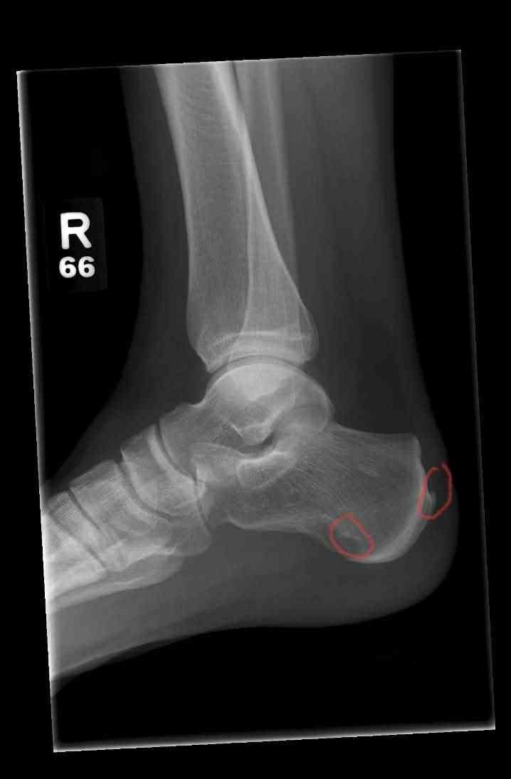 Aid for living costs and unforeseen injury and expenses. campaign photo, 2 of 5