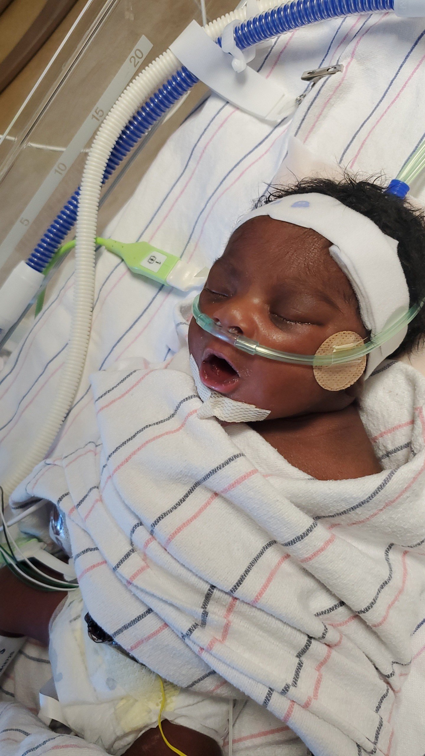 Help Baby Aaria's Heart Journey campaign photo, 4 of 8