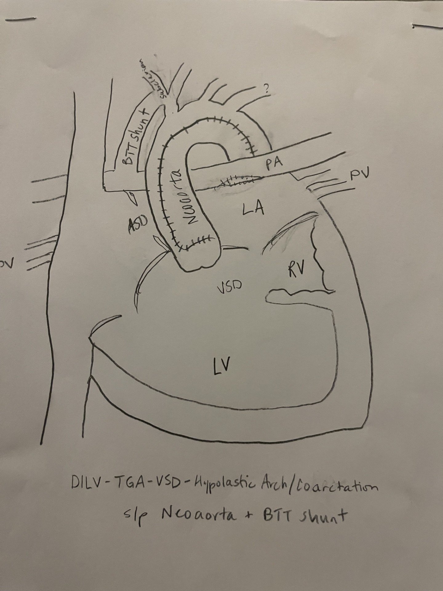Help Baby Aaria's Heart Journey campaign photo, 6 of 8