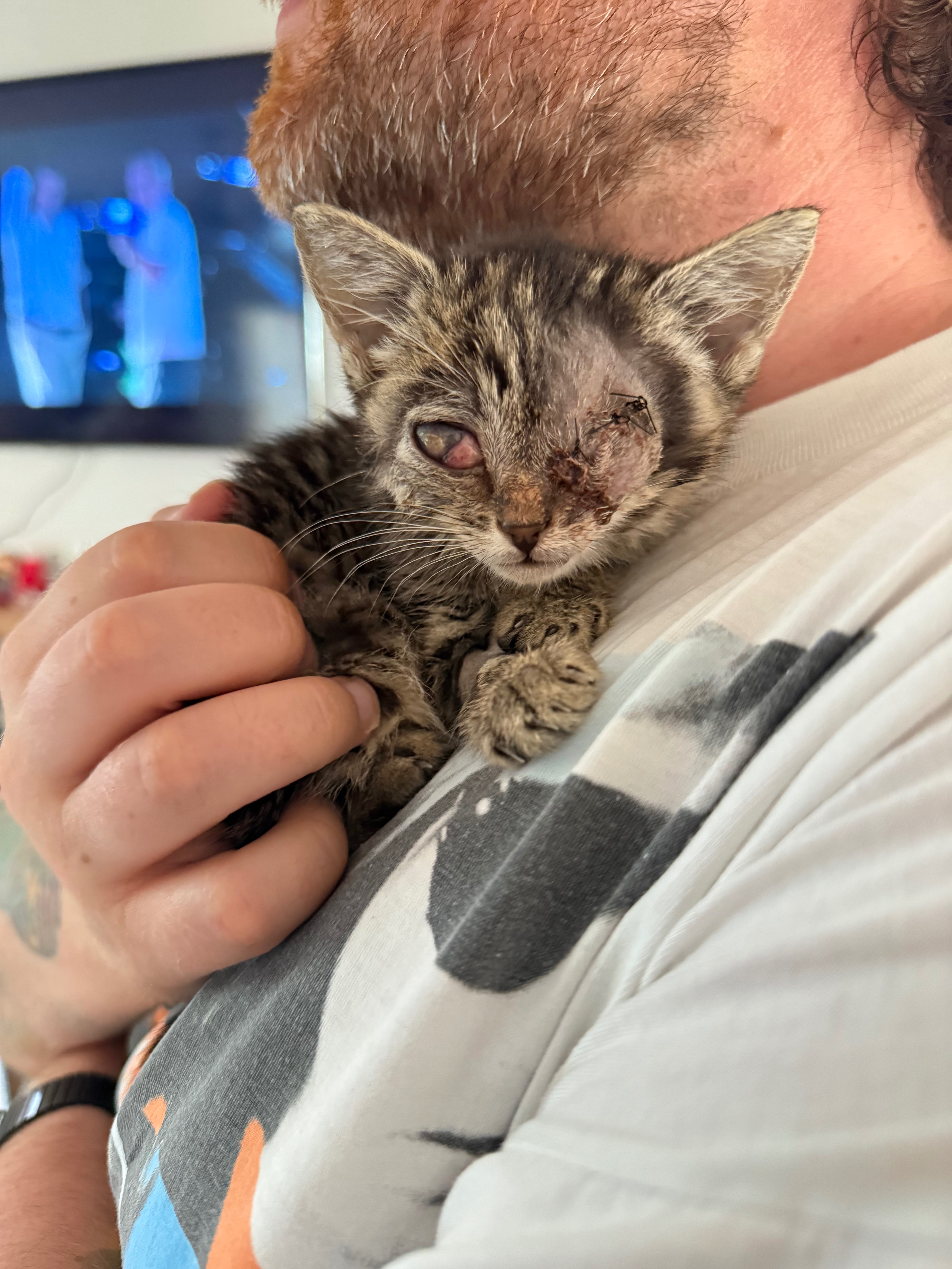 Please help with Sid’s surgeries campaign photo, 4 of 8
