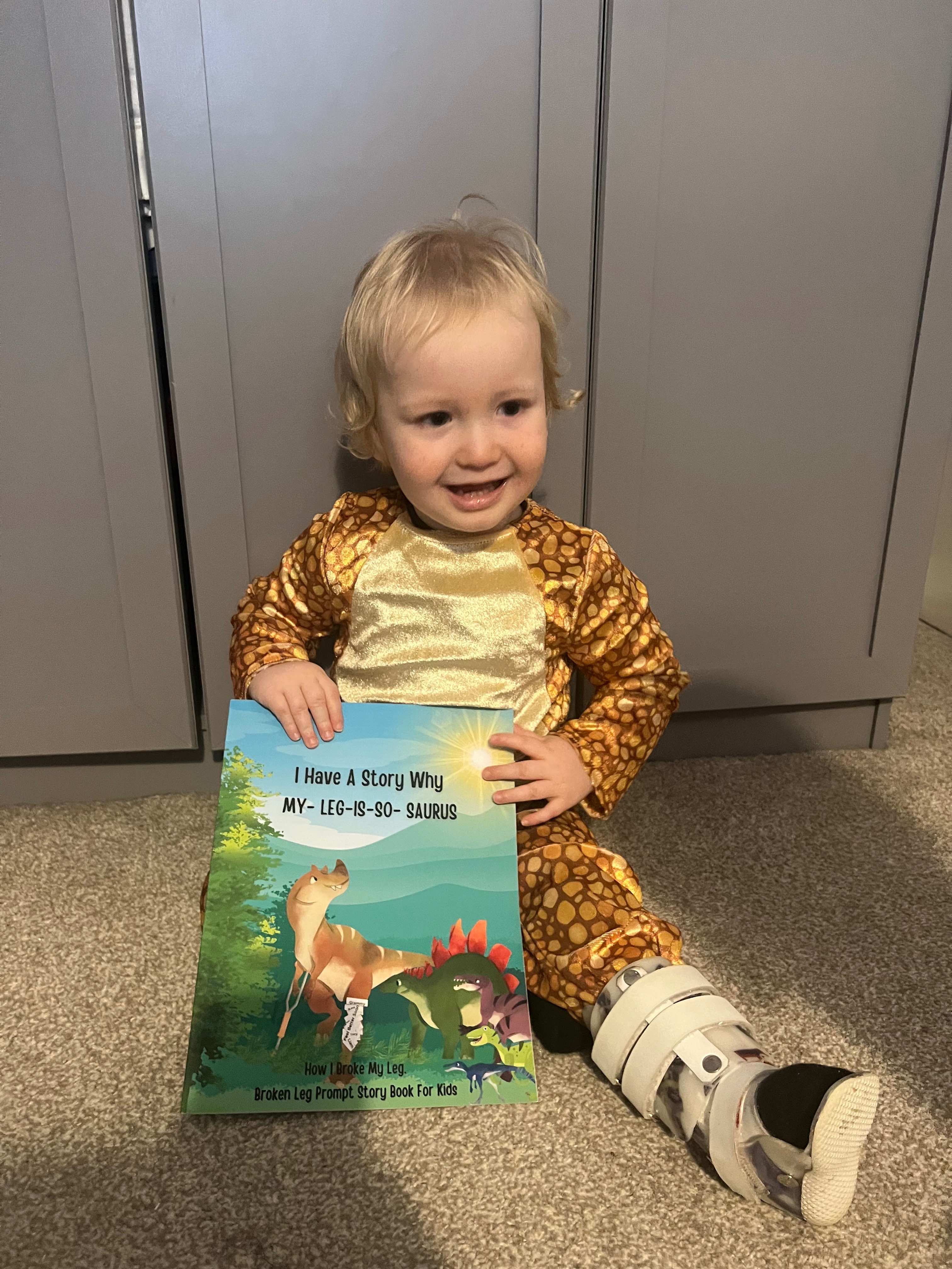 Supporting Carson’s Congenital Pseudoarthrosis Journey campaign photo, 4 of 8
