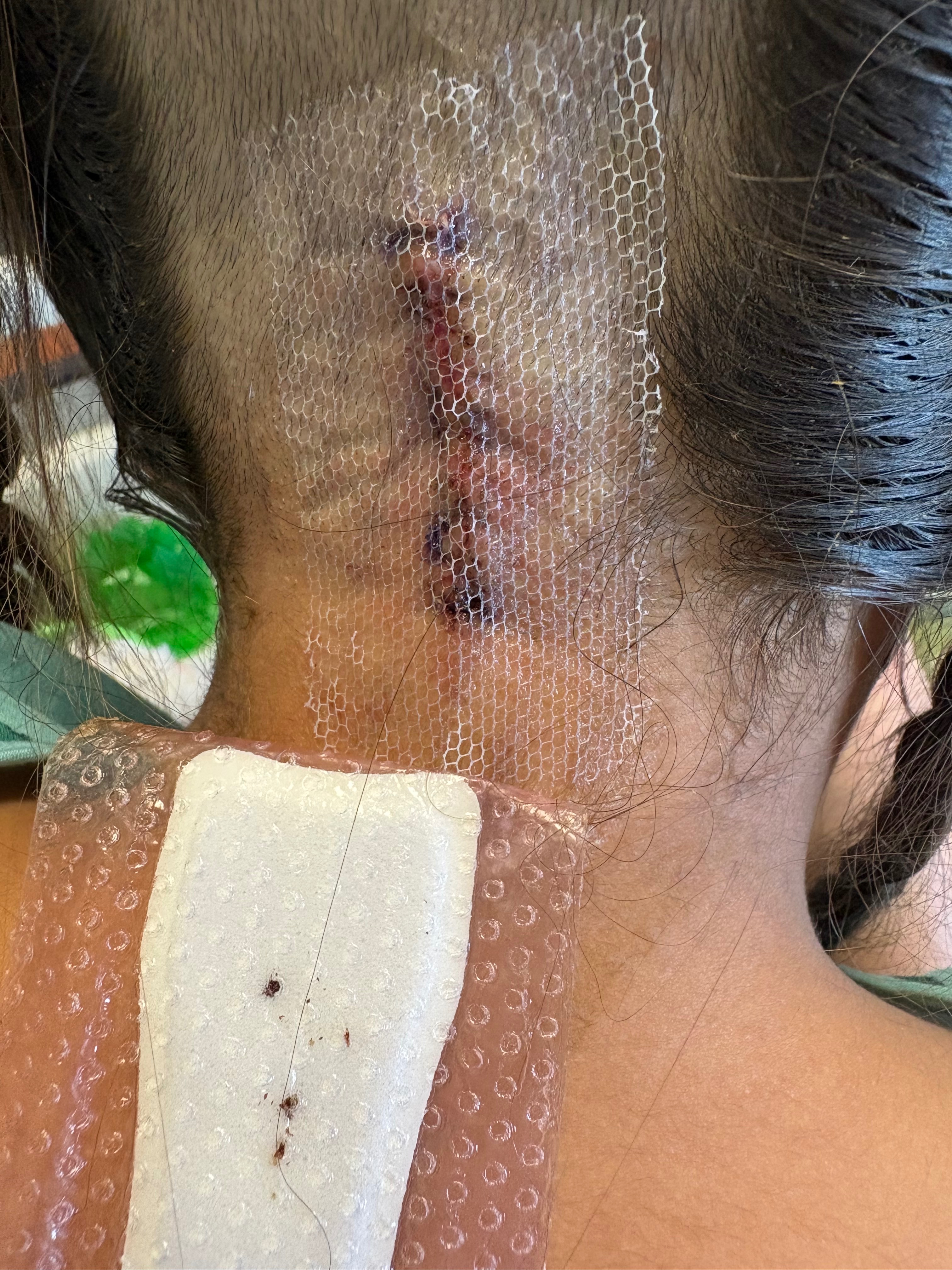 Support Xiomara’s Fight Against Brainstem Glioma campaign photo, 7 of 8