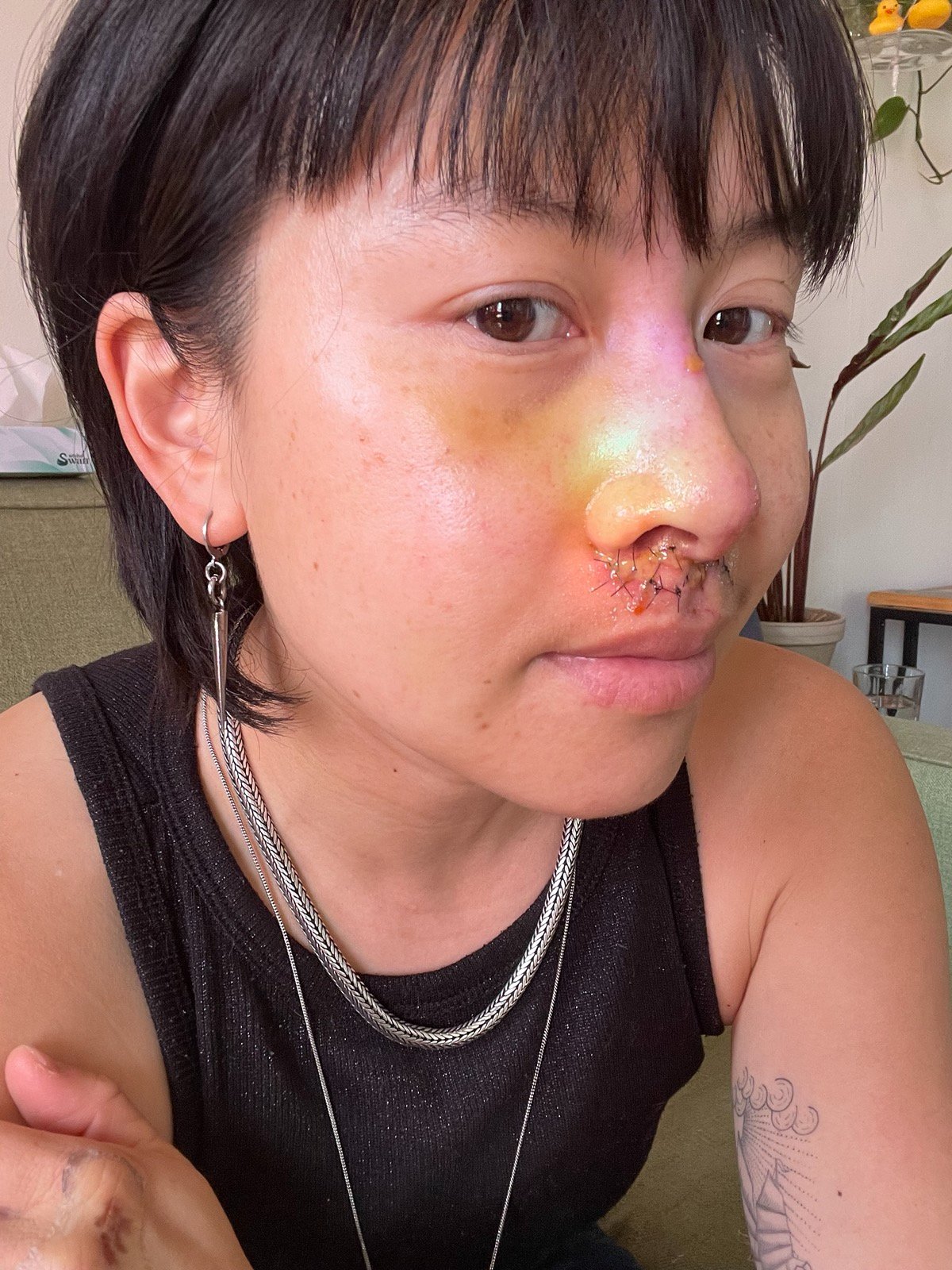 Help Nancy Heal from a Devastating Bike Accident campaign photo, 7 of 7