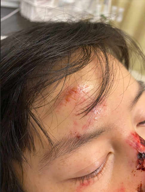 Help Nancy Heal from a Devastating Bike Accident campaign photo, 2 of 7