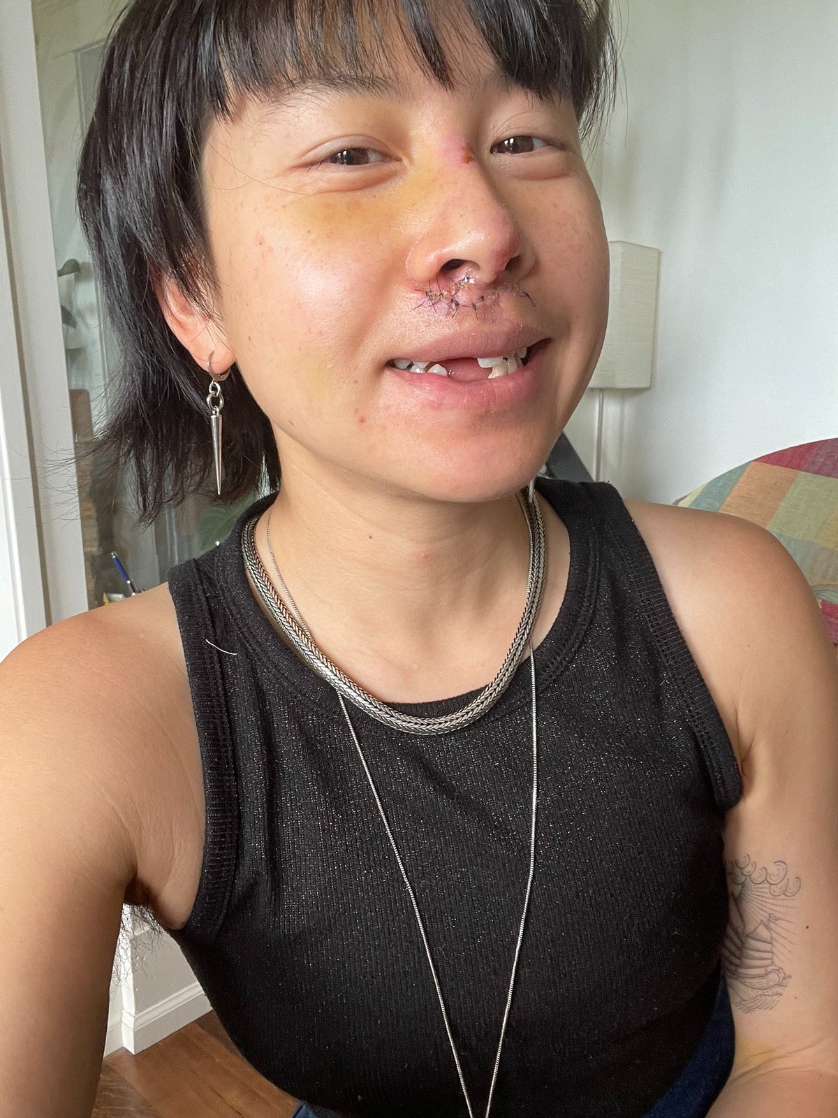 Help Nancy Heal from a Devastating Bike Accident campaign photo, 4 of 7