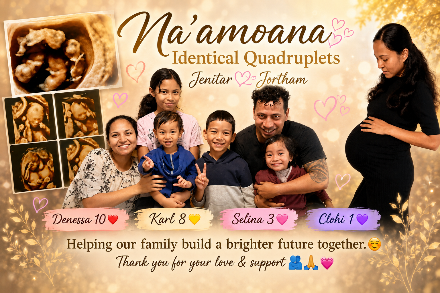 HELP CARE FOR AUSTRALIA'S FIRST KNOWN IDENTICAL QUADS. campaign photo, 5 of 7