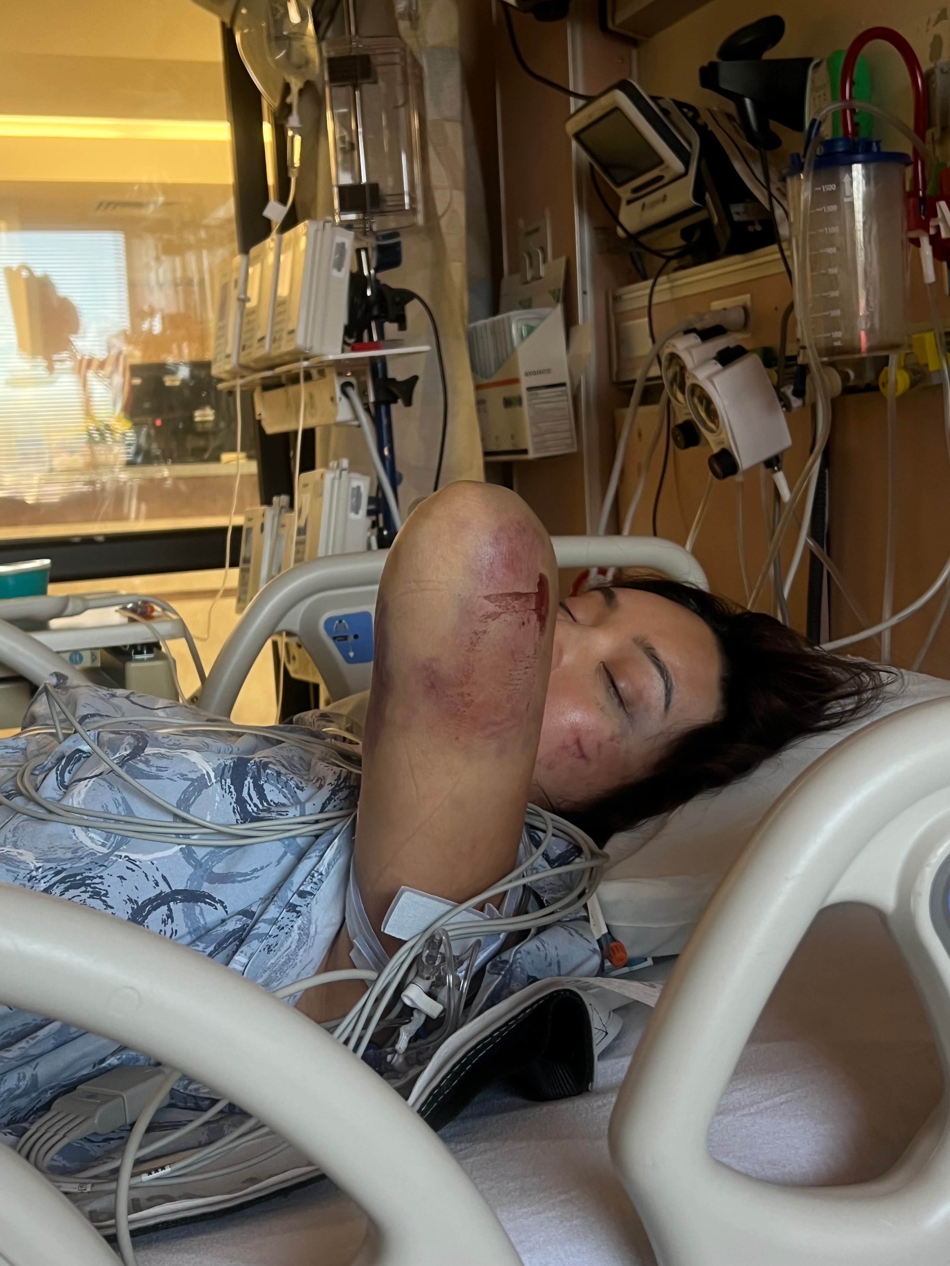Support Kataluna's Healing Journey After the Accident campaign photo, 4 of 5