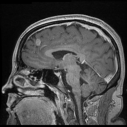 Please Help with Mri expenses due to brain and spine tumors campaign photo, 4 of 8
