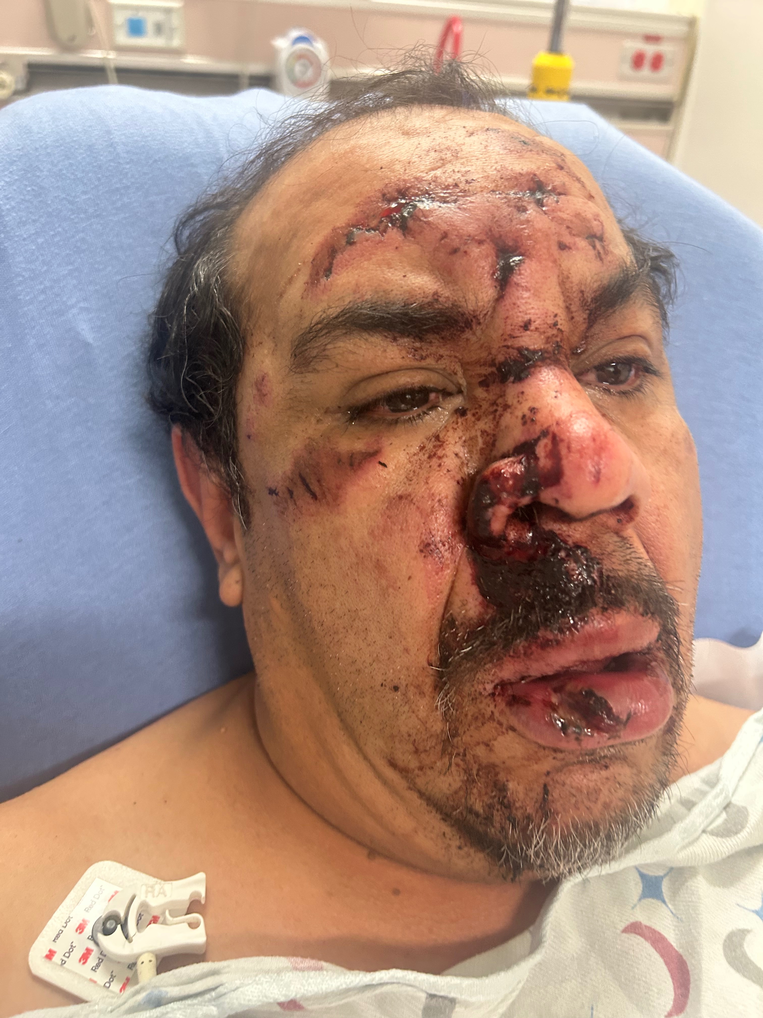 Support for Dad’s Recovery After Severe Injuries campaign photo, 2 of 4