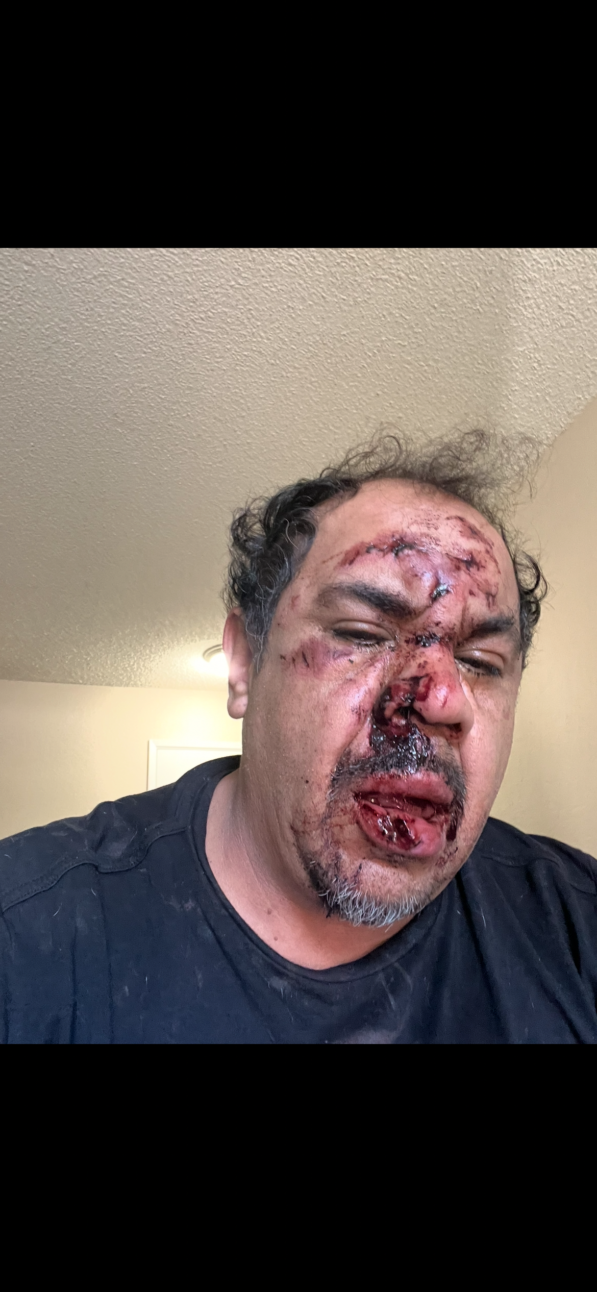 Support for Dad’s Recovery After Severe Injuries campaign photo, 5 of 6
