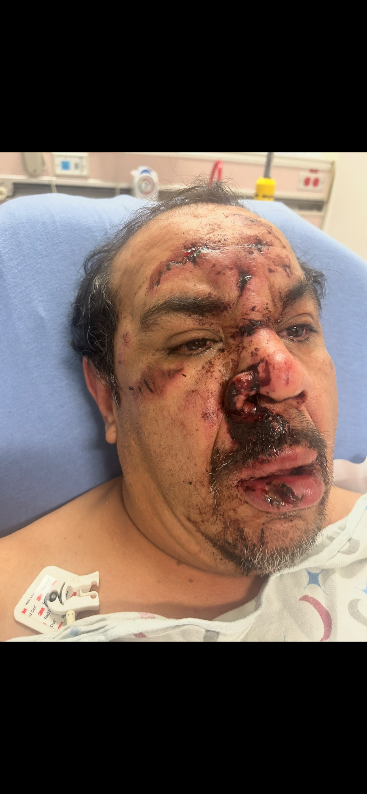 Support for Dad’s Recovery After Severe Injuries campaign photo, 4 of 6