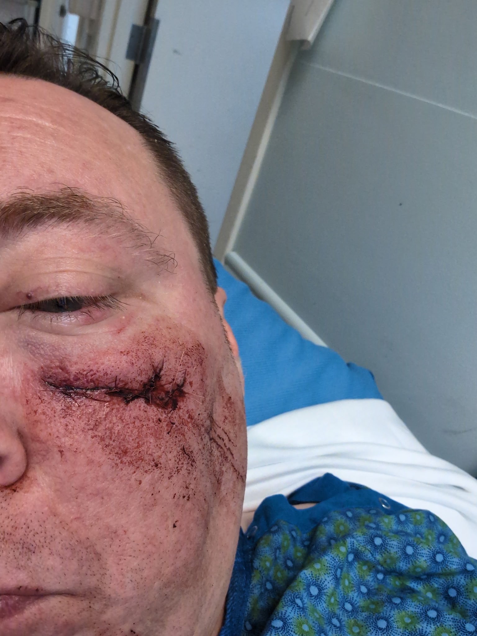 Help Christian Recover after hit by driver campaign photo, 4 of 5