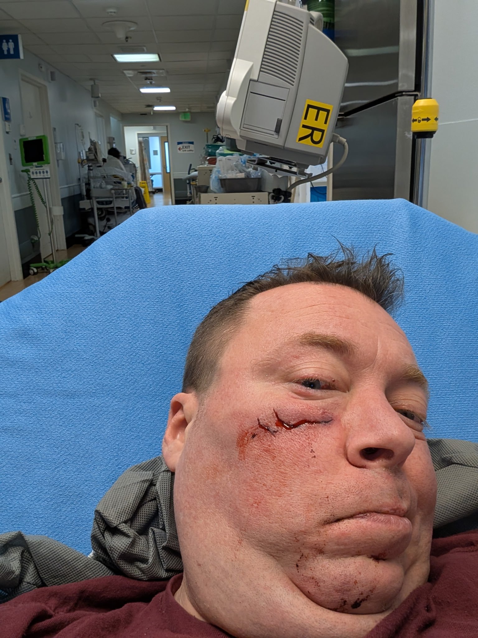Help Christian Recover after hit by driver campaign photo, 2 of 5