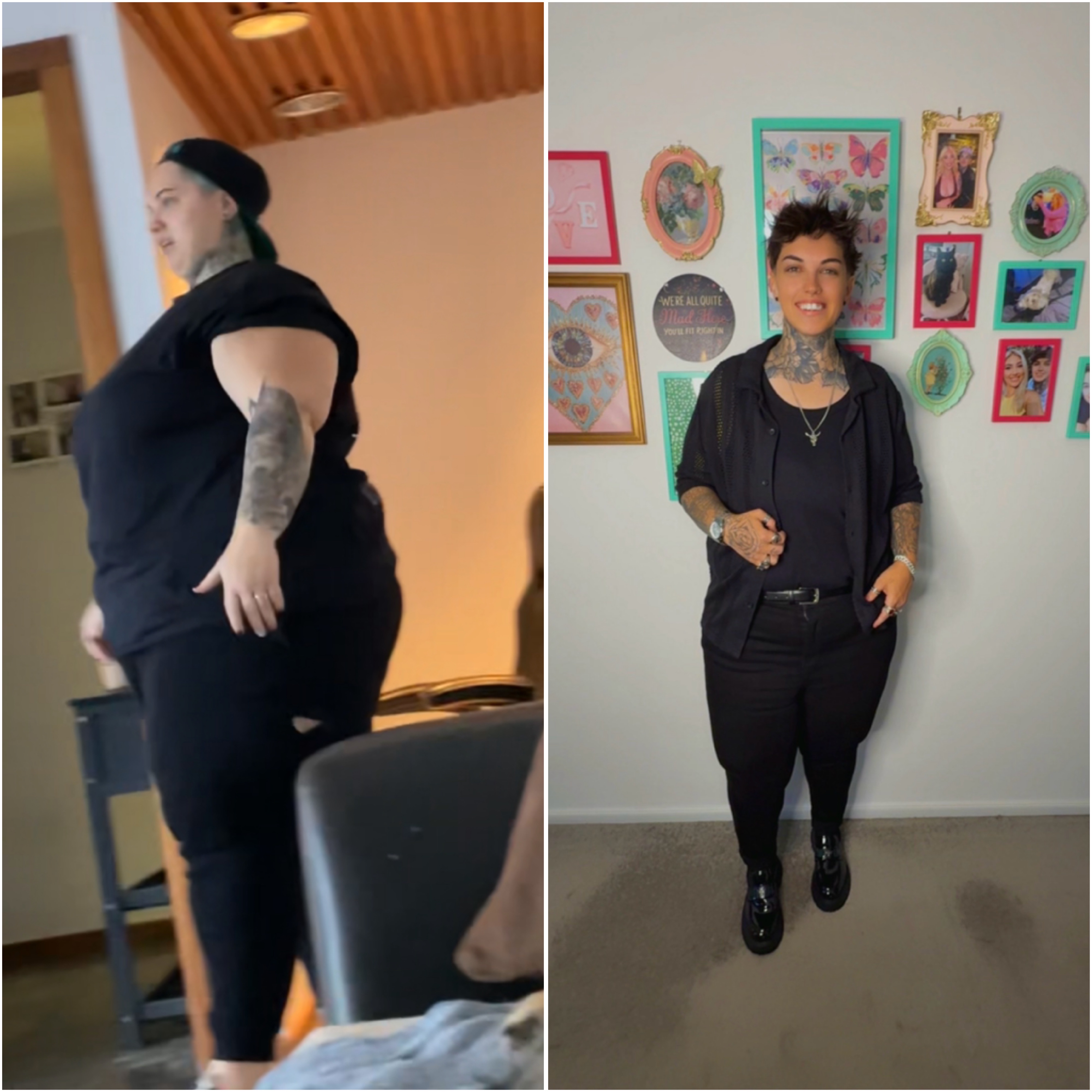 130kg Down. One Final Step: Skin Removal Surgery ❤️✂️ campaign photo, 7 of 8