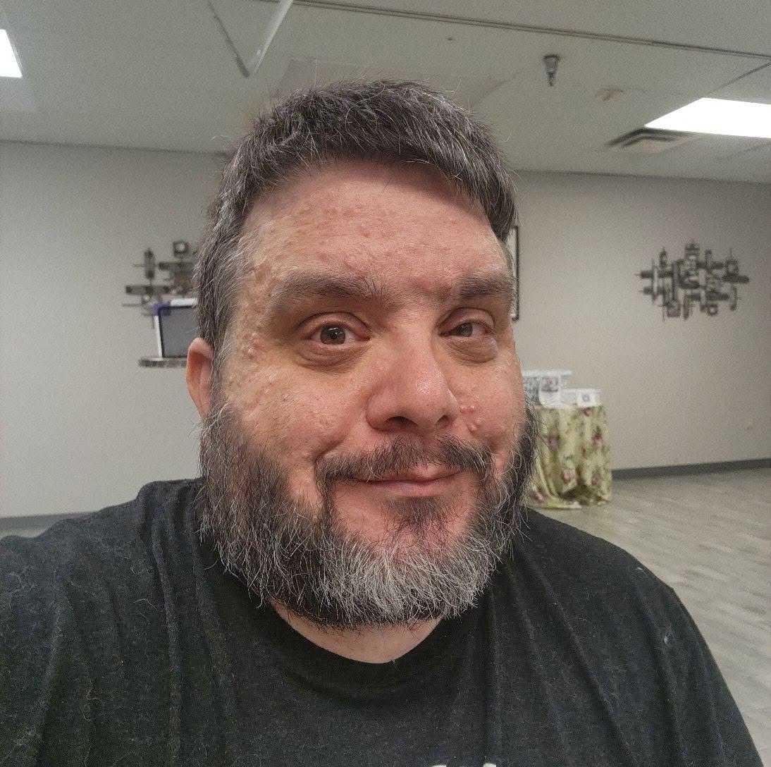 Support Lee Moore's Fight Against Chronic Pain campaign photo, 2 of 5