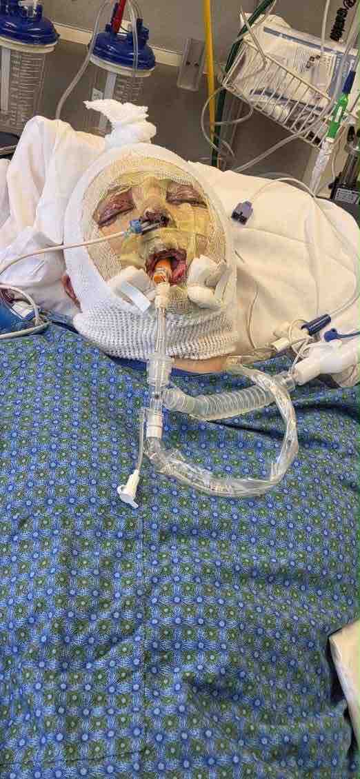 Support Kc's Healing Journey After Burn Accident campaign photo, 9 of 10