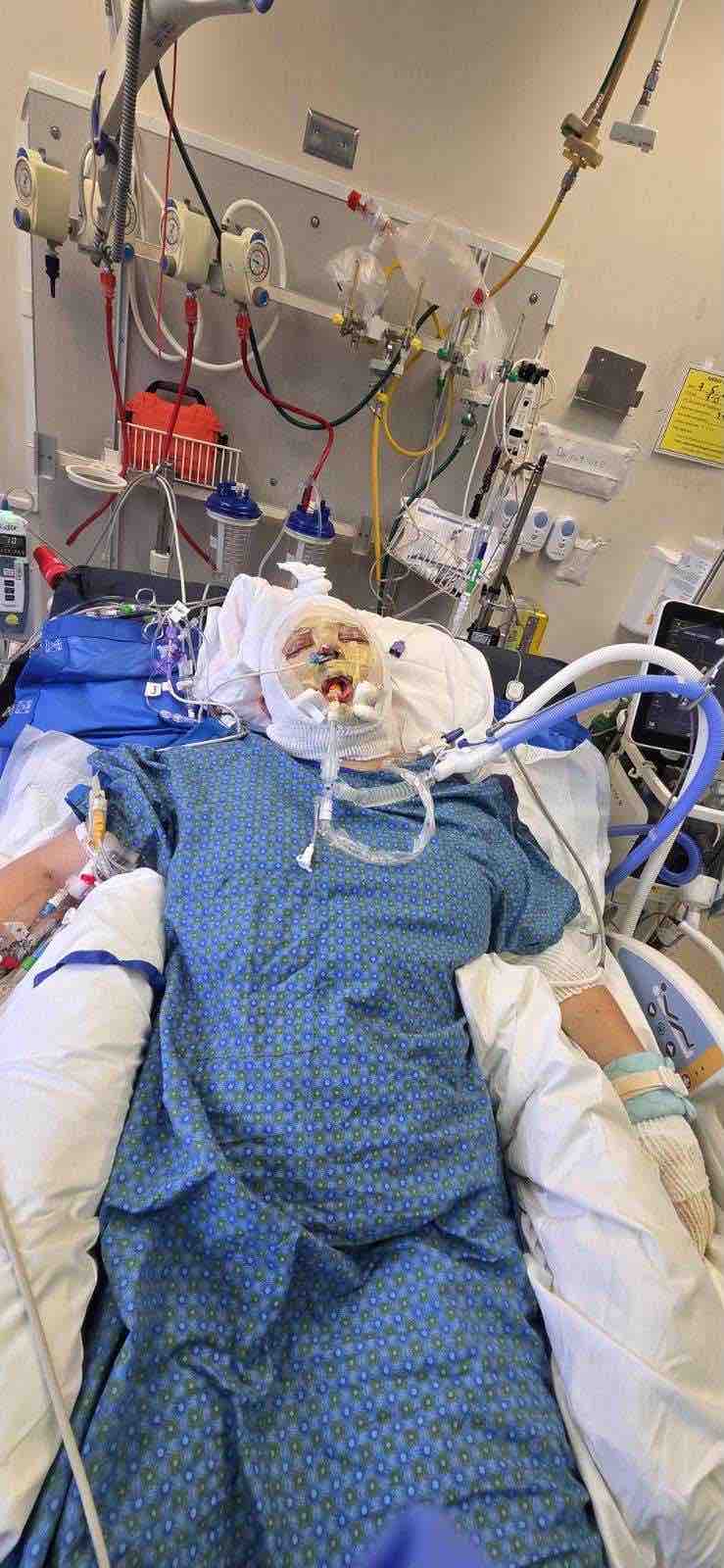 Support Kc's Healing Journey After Burn Accident campaign photo, 2 of 10