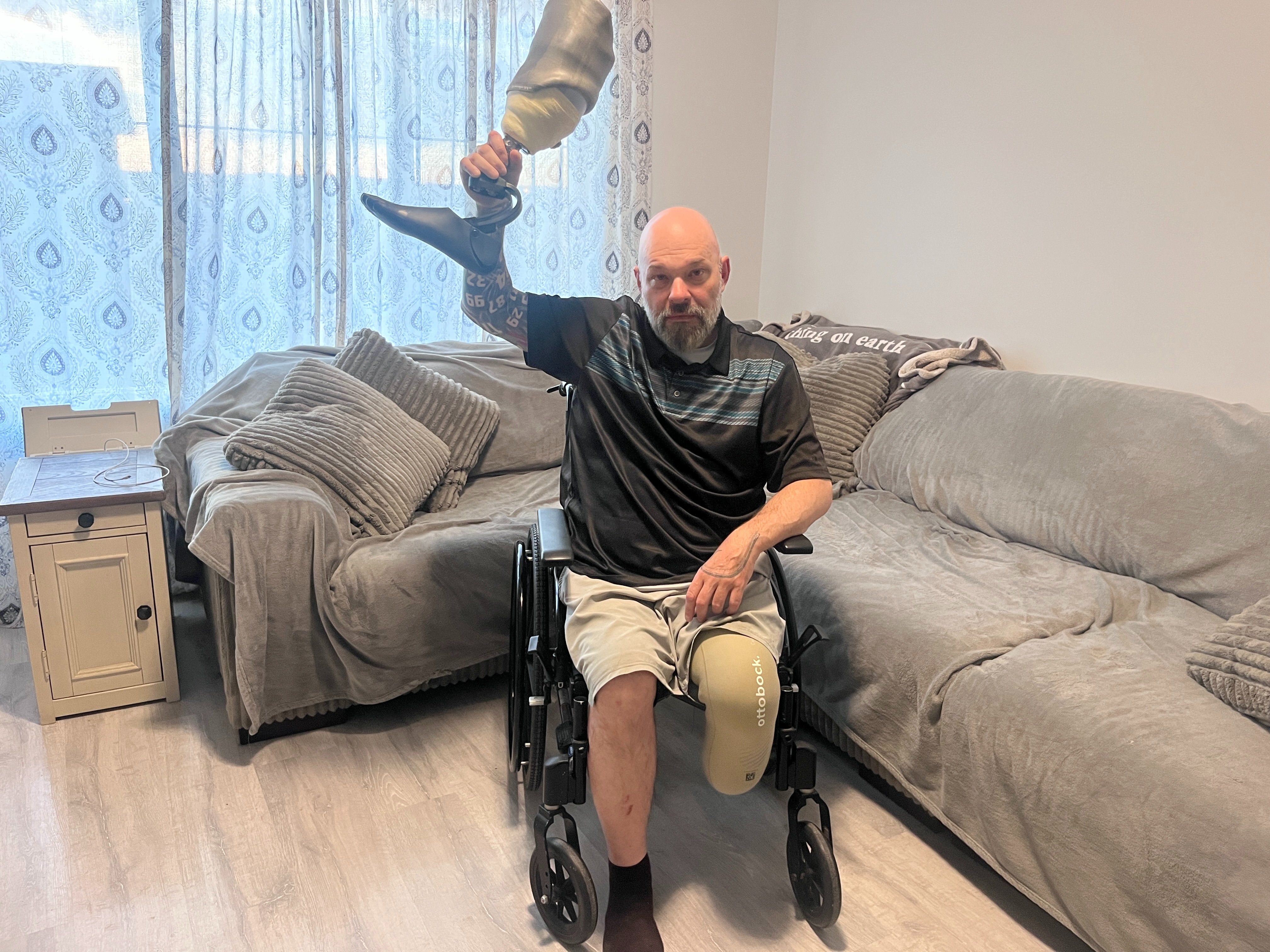 Help Ricardo Recover and Rebuild After Amputation campaign photo, 4 of 6