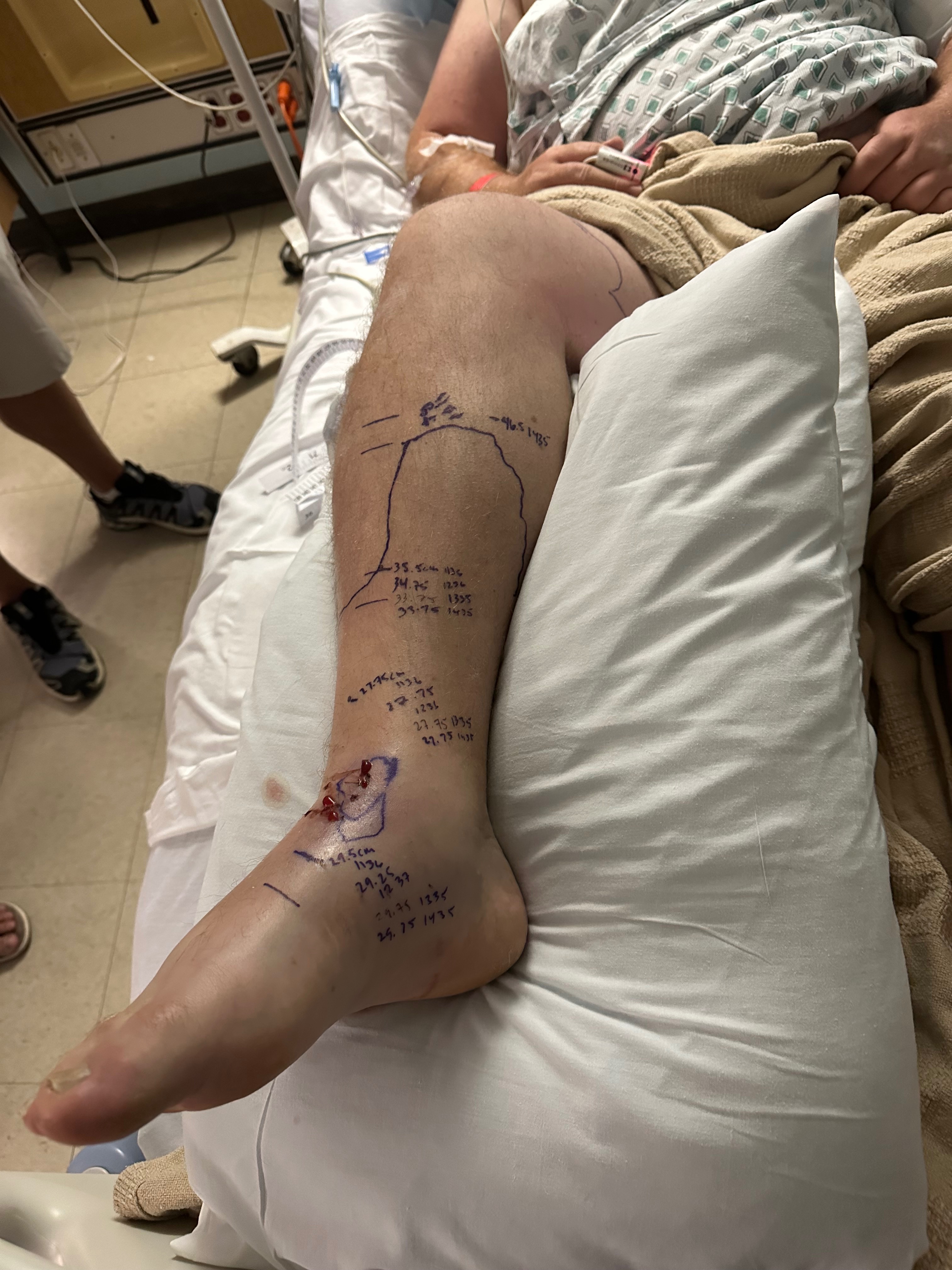 Help Chris Recover from Rattlesnake Bite campaign photo, 2 of 8