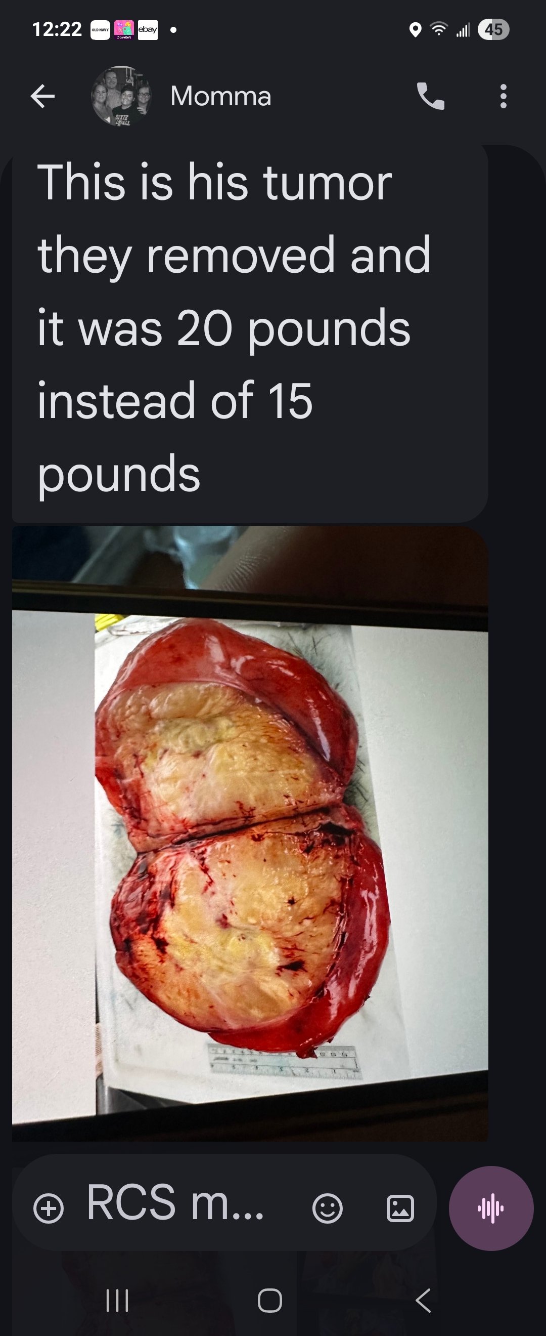 Help Joey Recover After Major Cancer Surgery campaign photo, 2 of 8