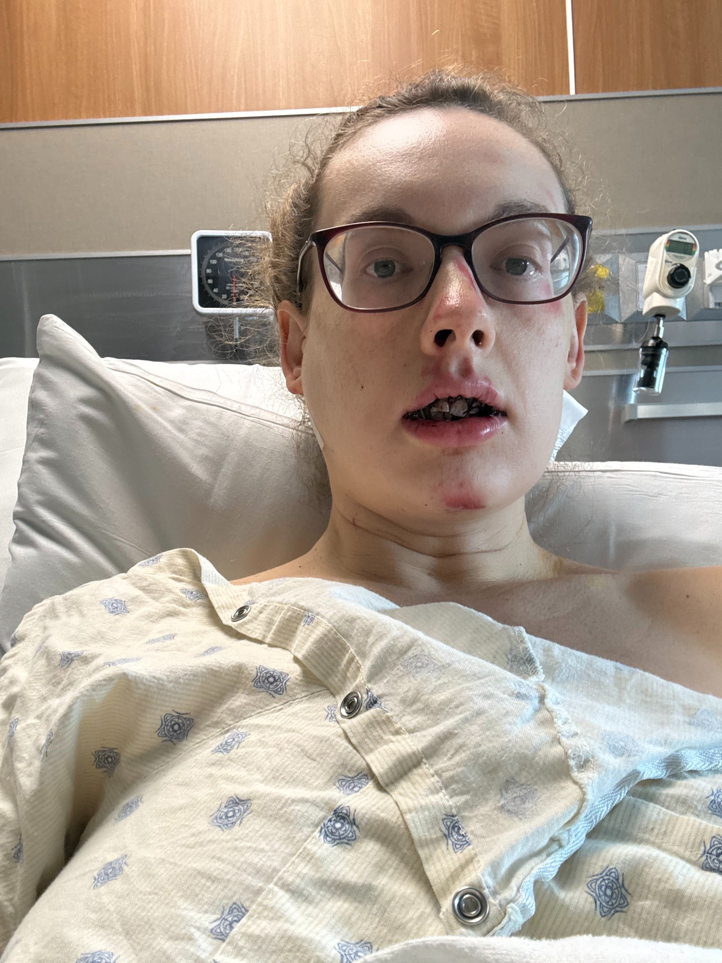 Help Blair Get Her Smile Back After Crash campaign photo, 7 of 8