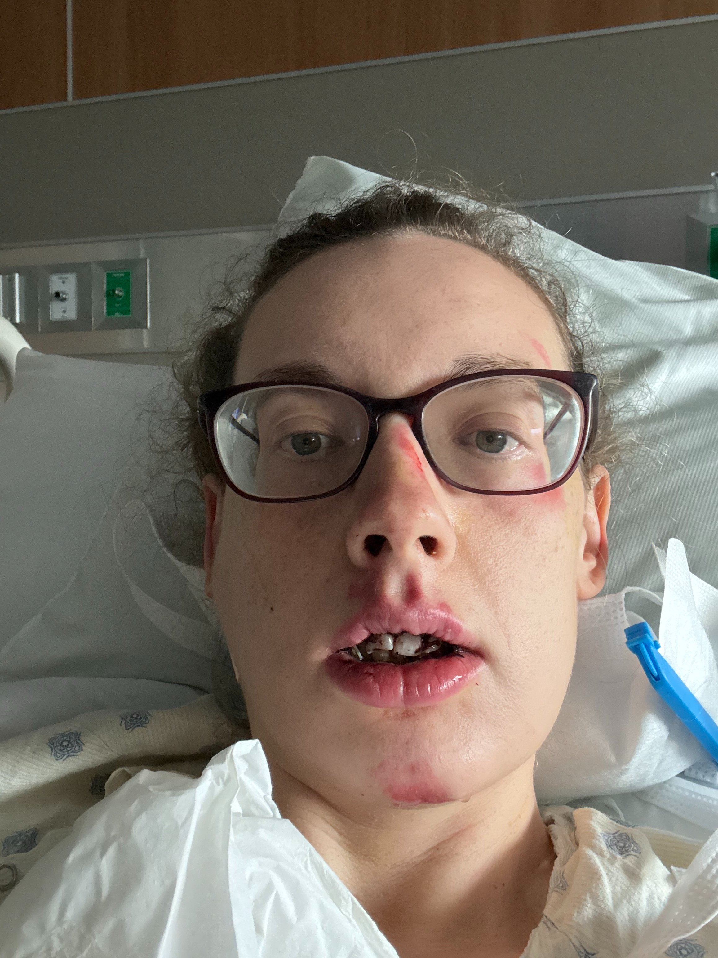 Help Blair Get Her Smile Back After Crash campaign photo, 4 of 8